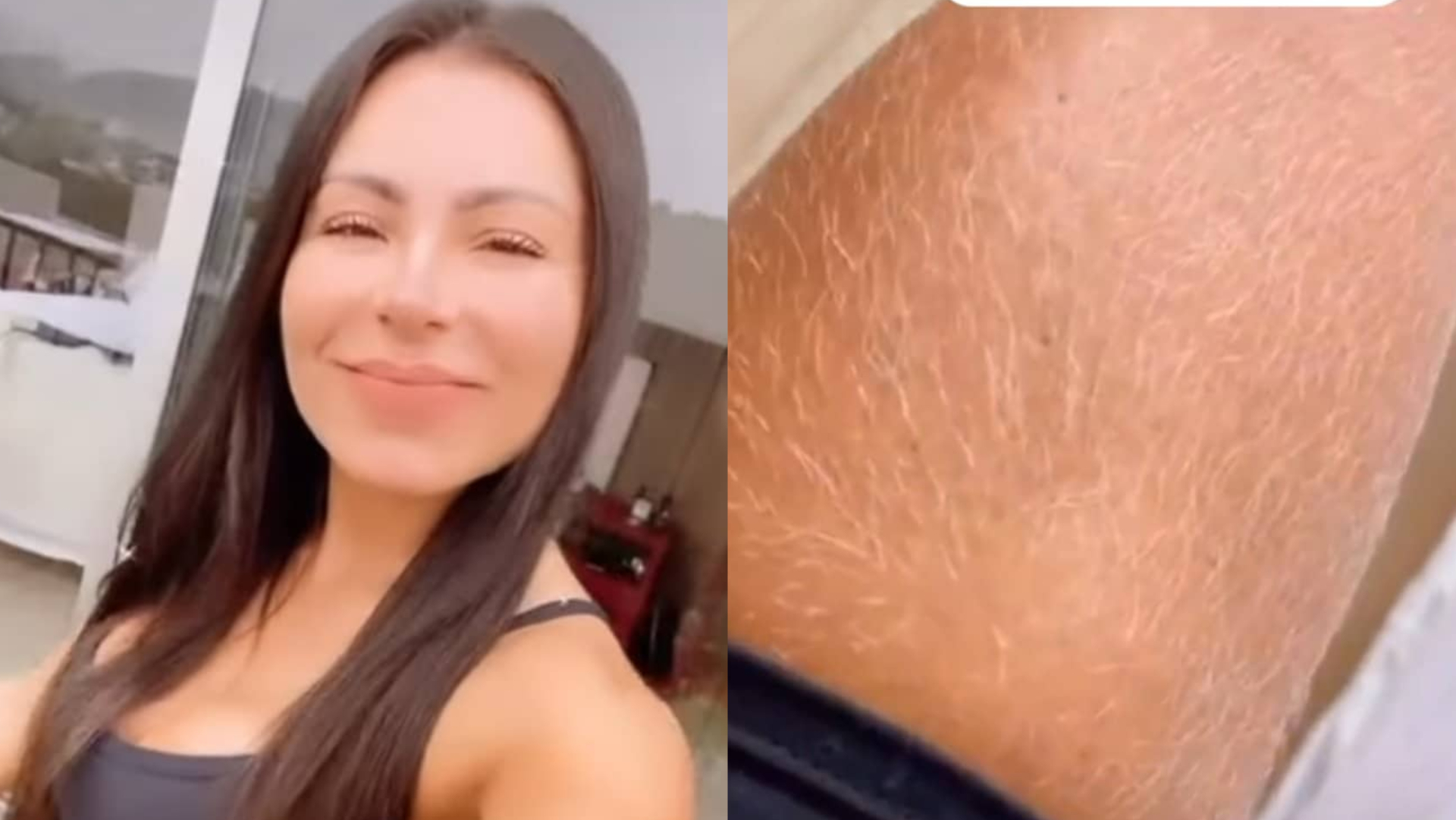 Nora de Gretchen mostra que também tem pelos loiros no corpo: ”Não depilo”