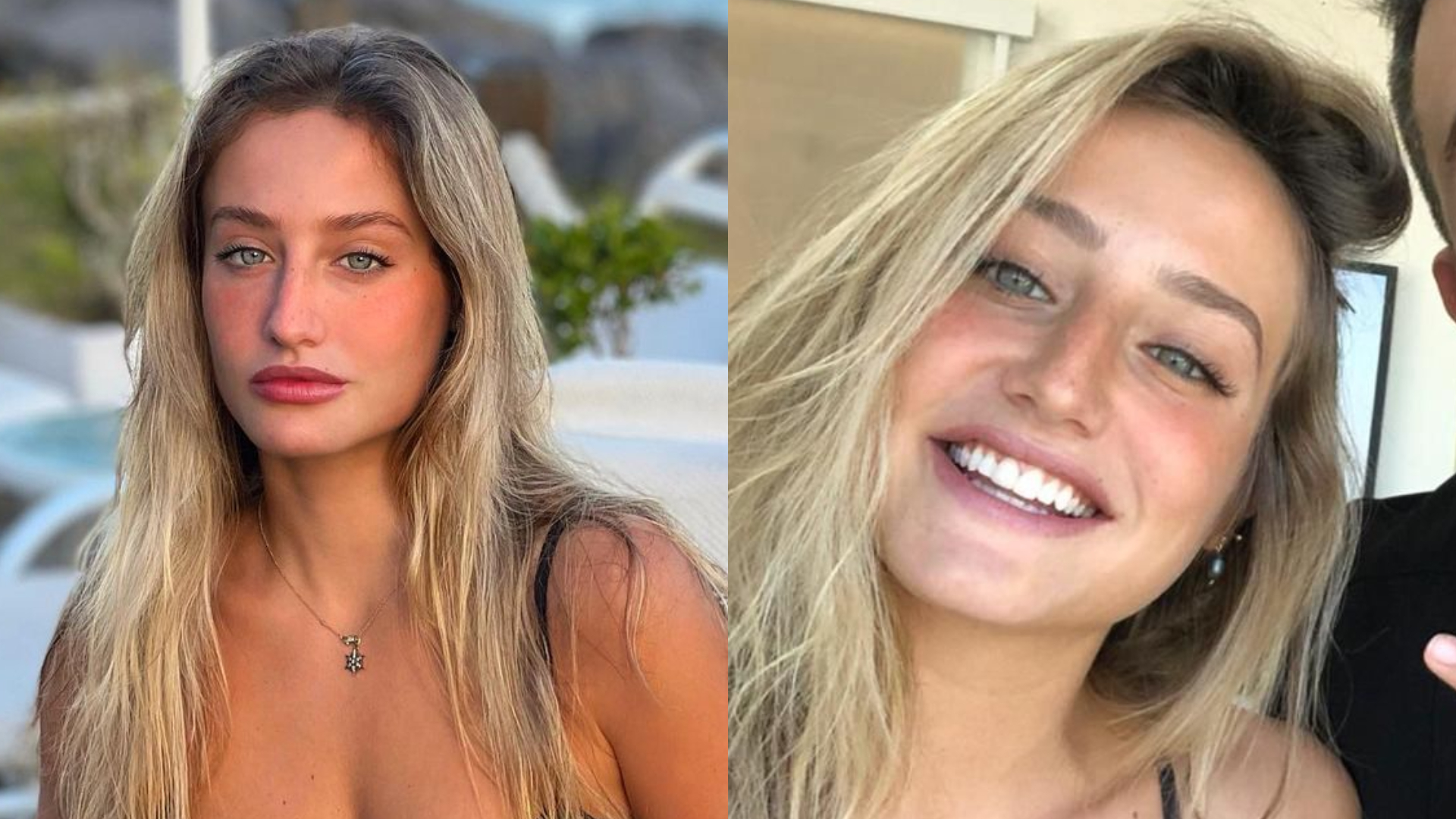 Bruna Griphao mostra novo sorriso e desabafa sobre vergonha: ”Eu acho que não sei sorrir”