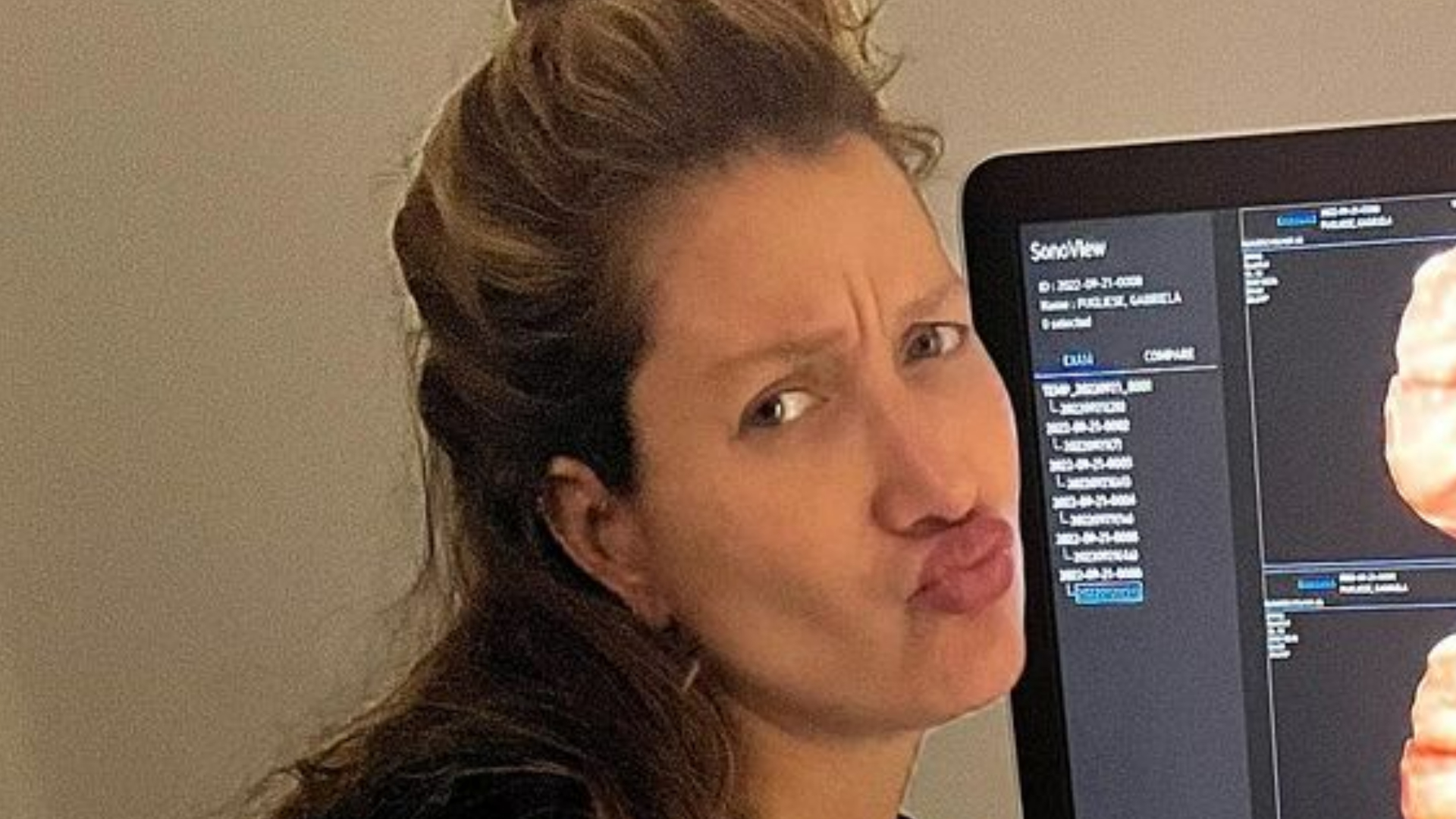 Gabriela Pugliesi se derrete ao ver o filho fazendo careta no ultrassom: ”Bicudo”