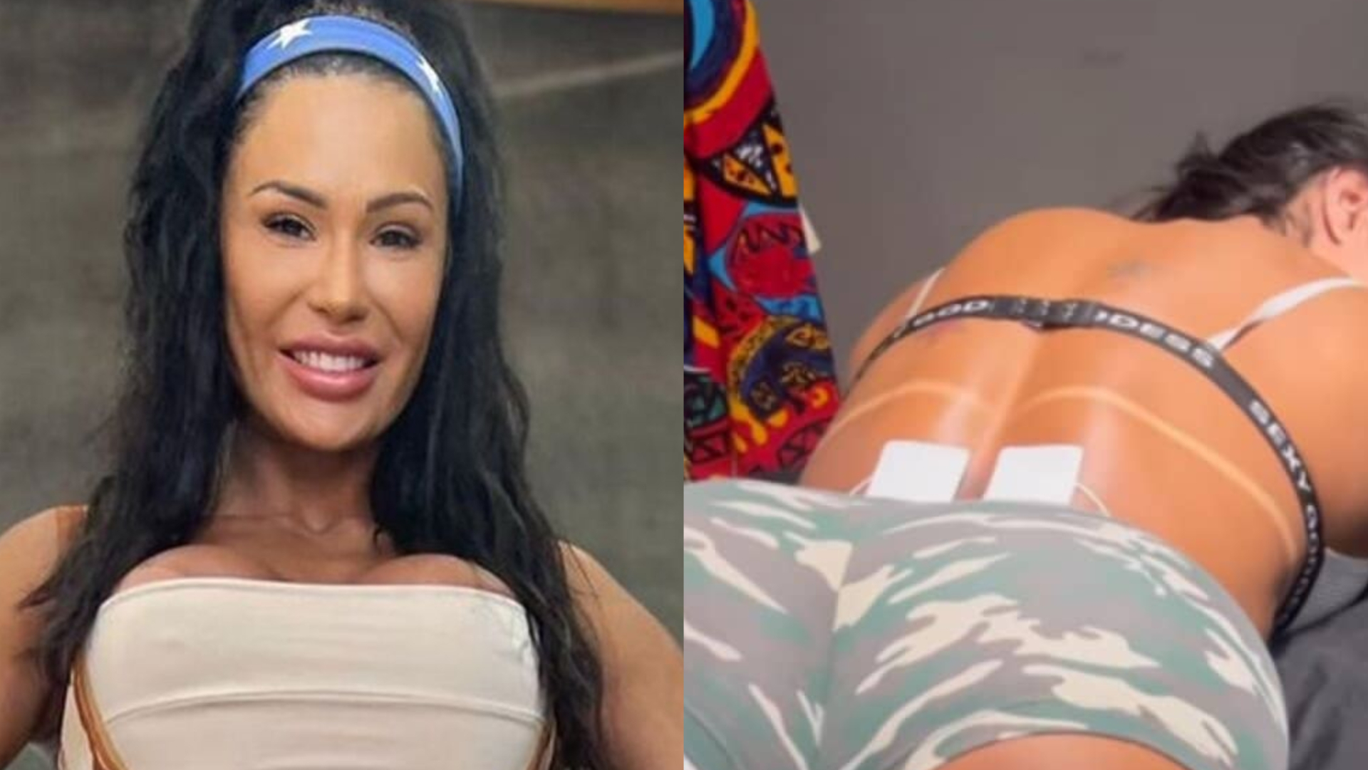 De micro shorts, Gracyanne Barbosa chama a atenção ao fazer fisioterapia no bumbum: ”Preventiva”