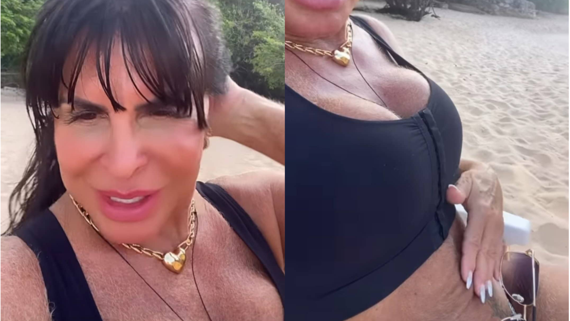 De sutiã cirúrgico, Gretchen toma sol e rebate críticas sobre não ter umbigo: ”Acabei de fazer ele”