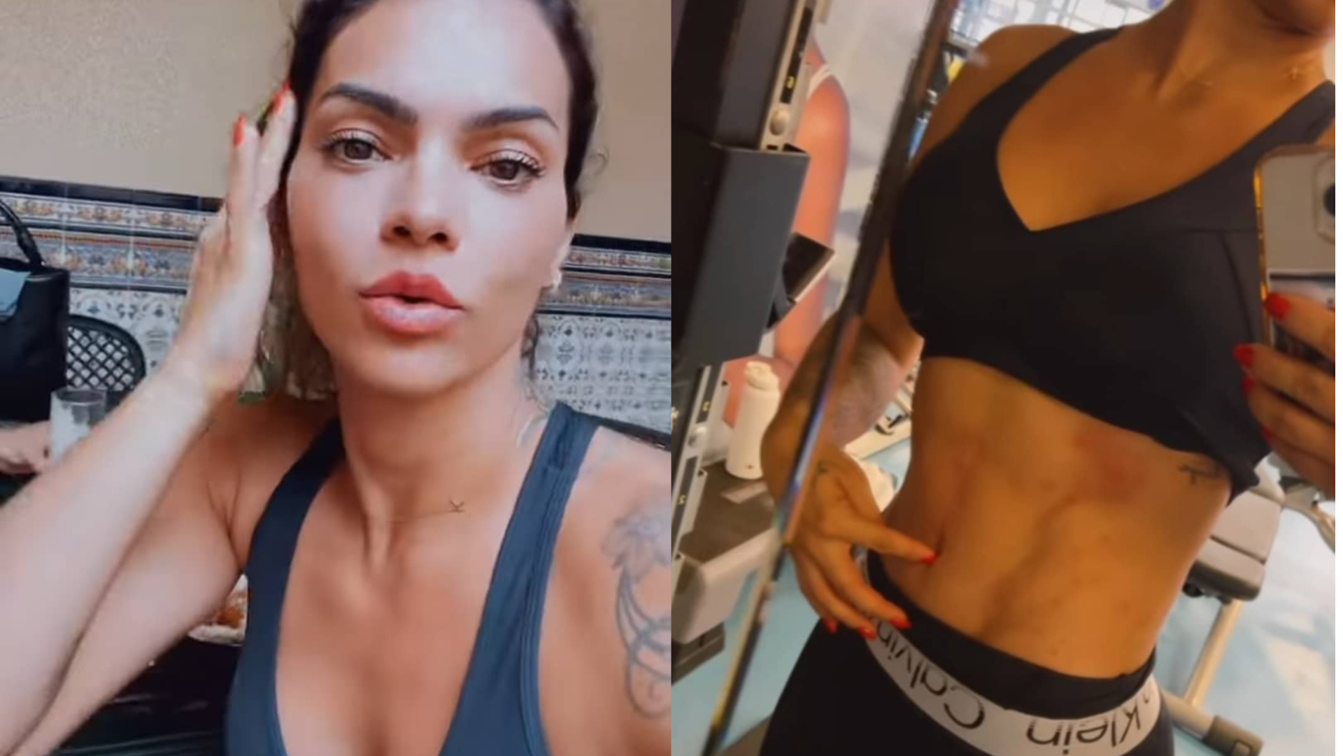Kelly Key surpreende ao mostrar barriga sarada cheia de manchas vermelhas: ”Fala por si só”