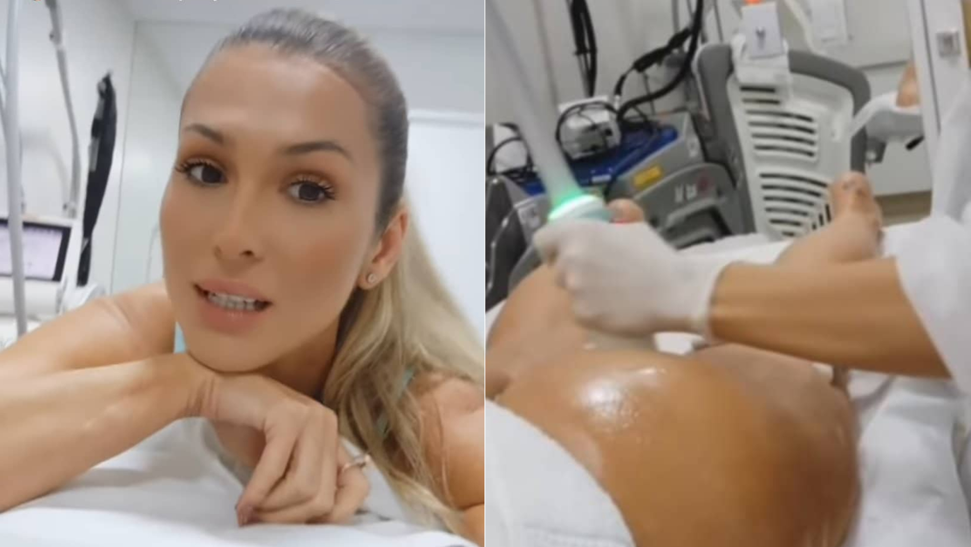 Lívia Andrade exibe bumbum virado para cima ao fazer procedimento no local