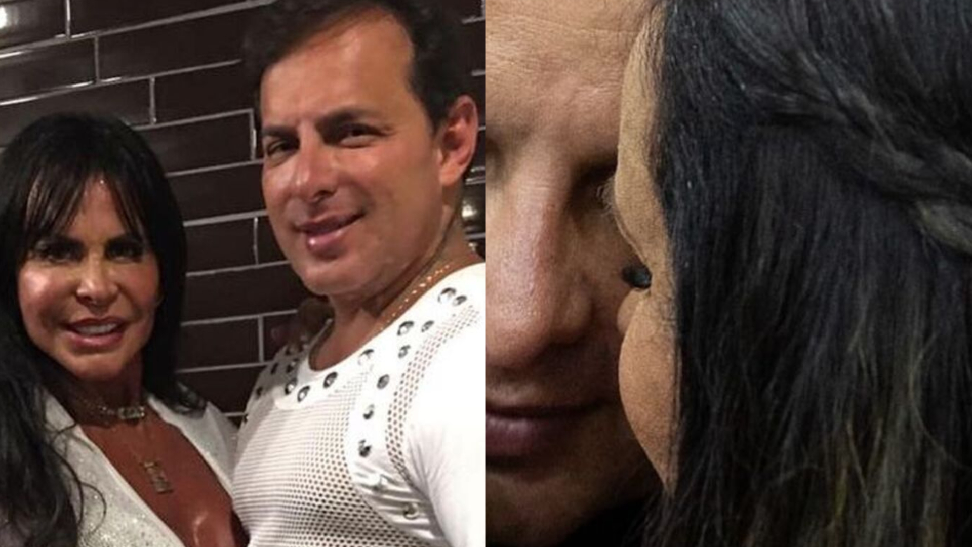 Gretchen mostra foto do marido antes das plásticas: ”Vou cuidar de você”