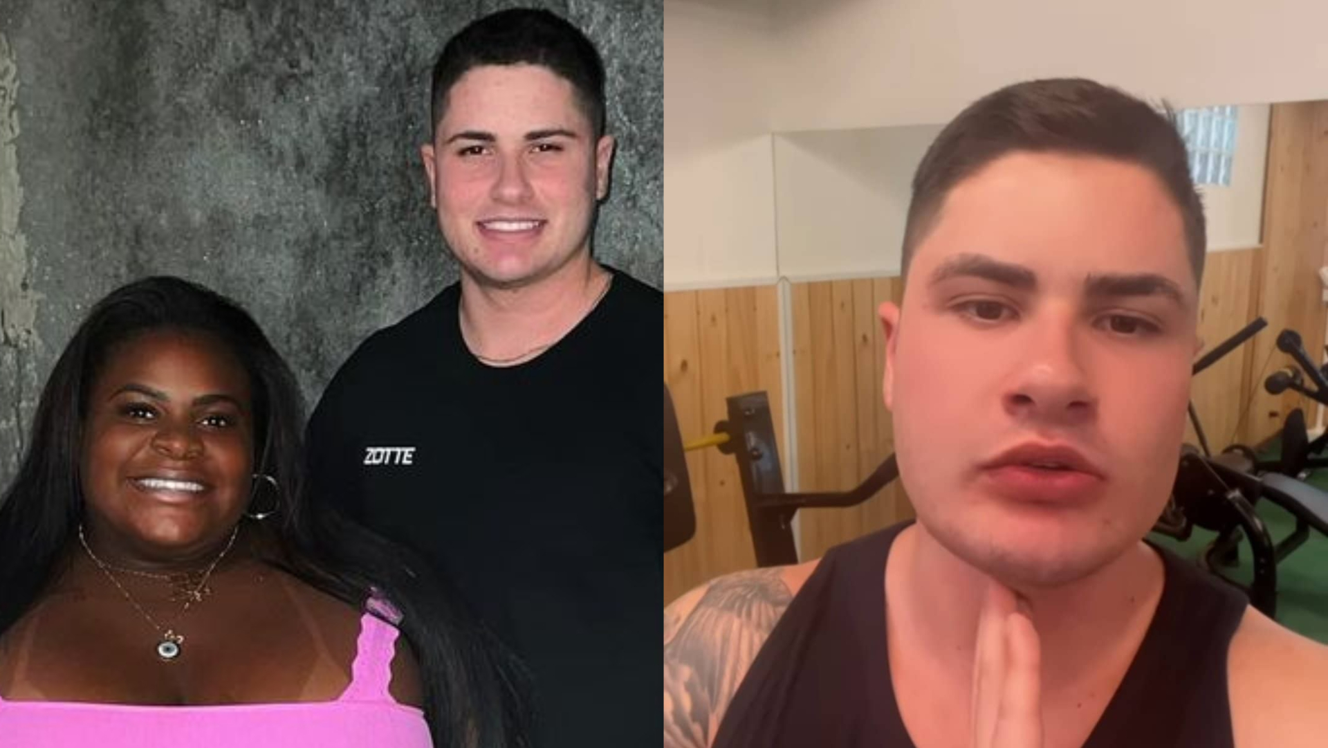 Marido de Jojo Todynho mostra resultado de preenchimento no rosto: ”Ficou excelente”
