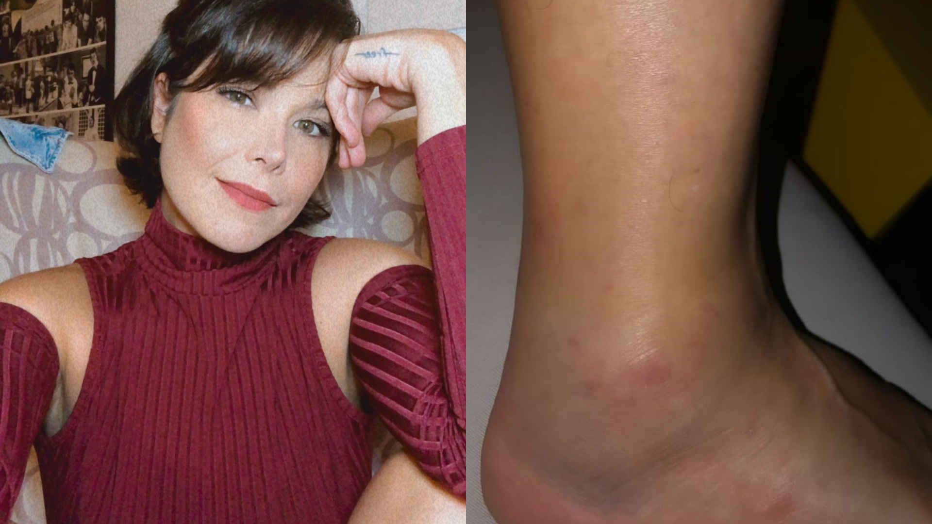 Samara Felippo desabafa após machucar o pé e atingir ligamentos: “Está horroroso”