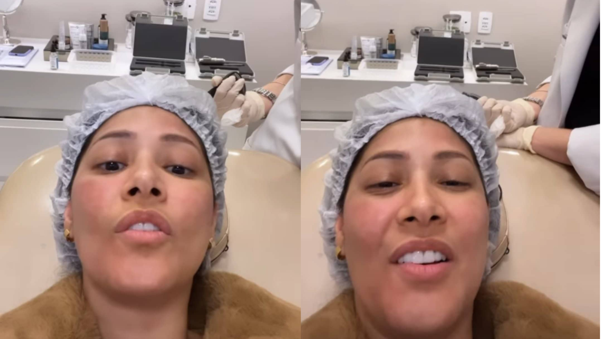 Simaria exibe rosto real e revela procedimento na papada: ”Cansei de tanta feiura”