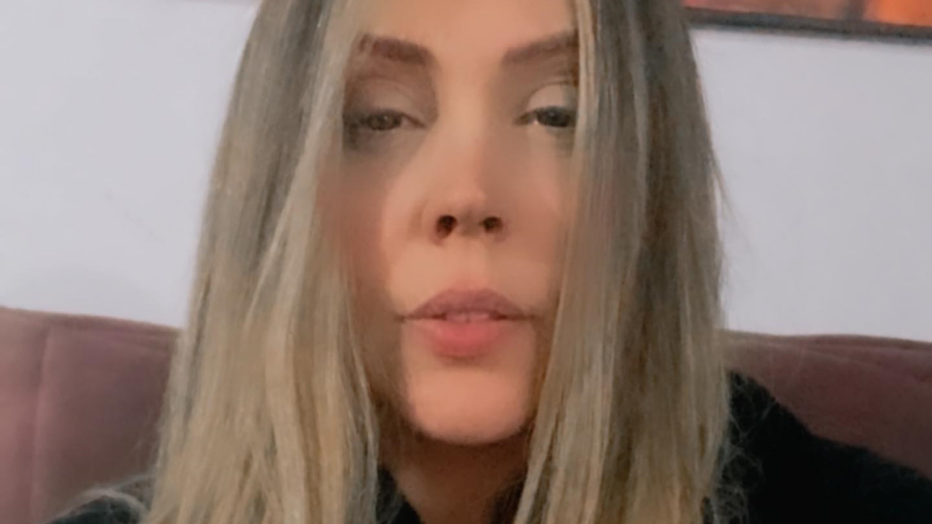 Simony abre o coração ao falar sobre perda dos cabelos em tratamento de câncer: “Díficil”