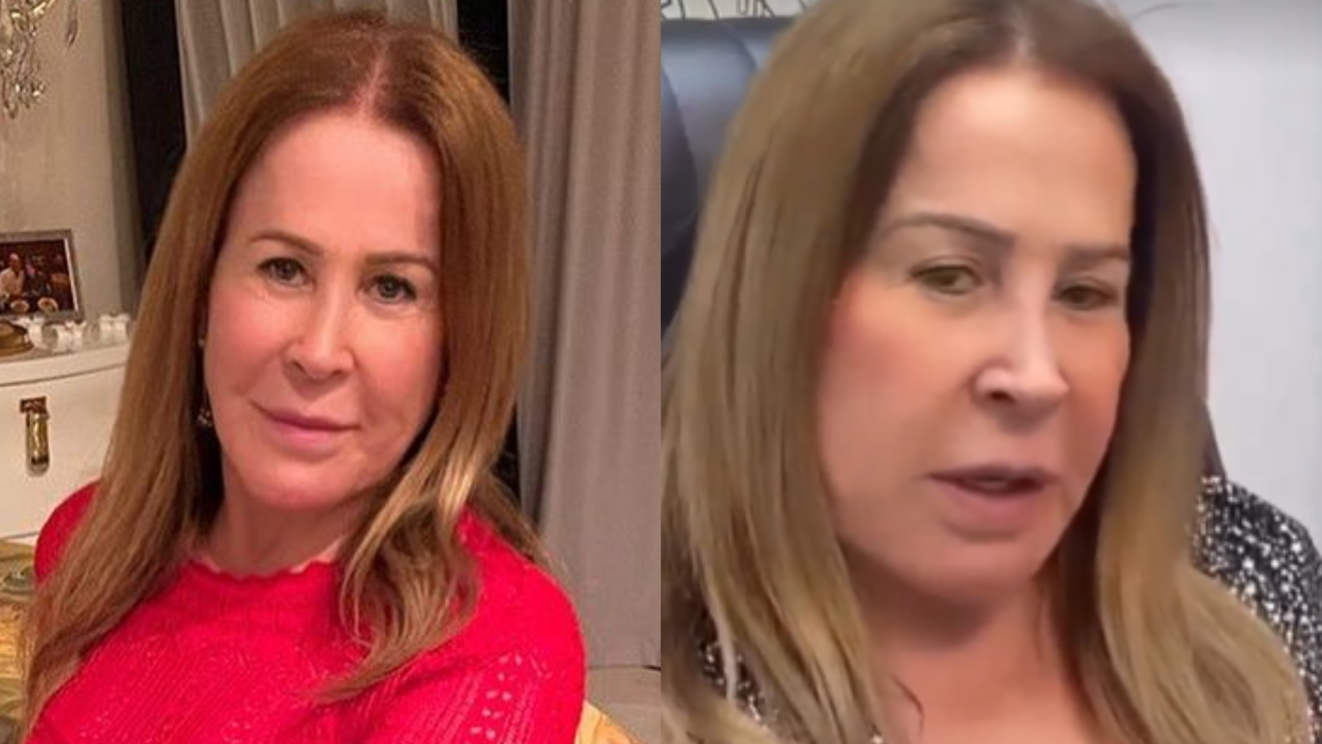 Aos 64 anos, Zilu Godoi explica cirurgia nos pés: ”Cuidando da minha saúde”