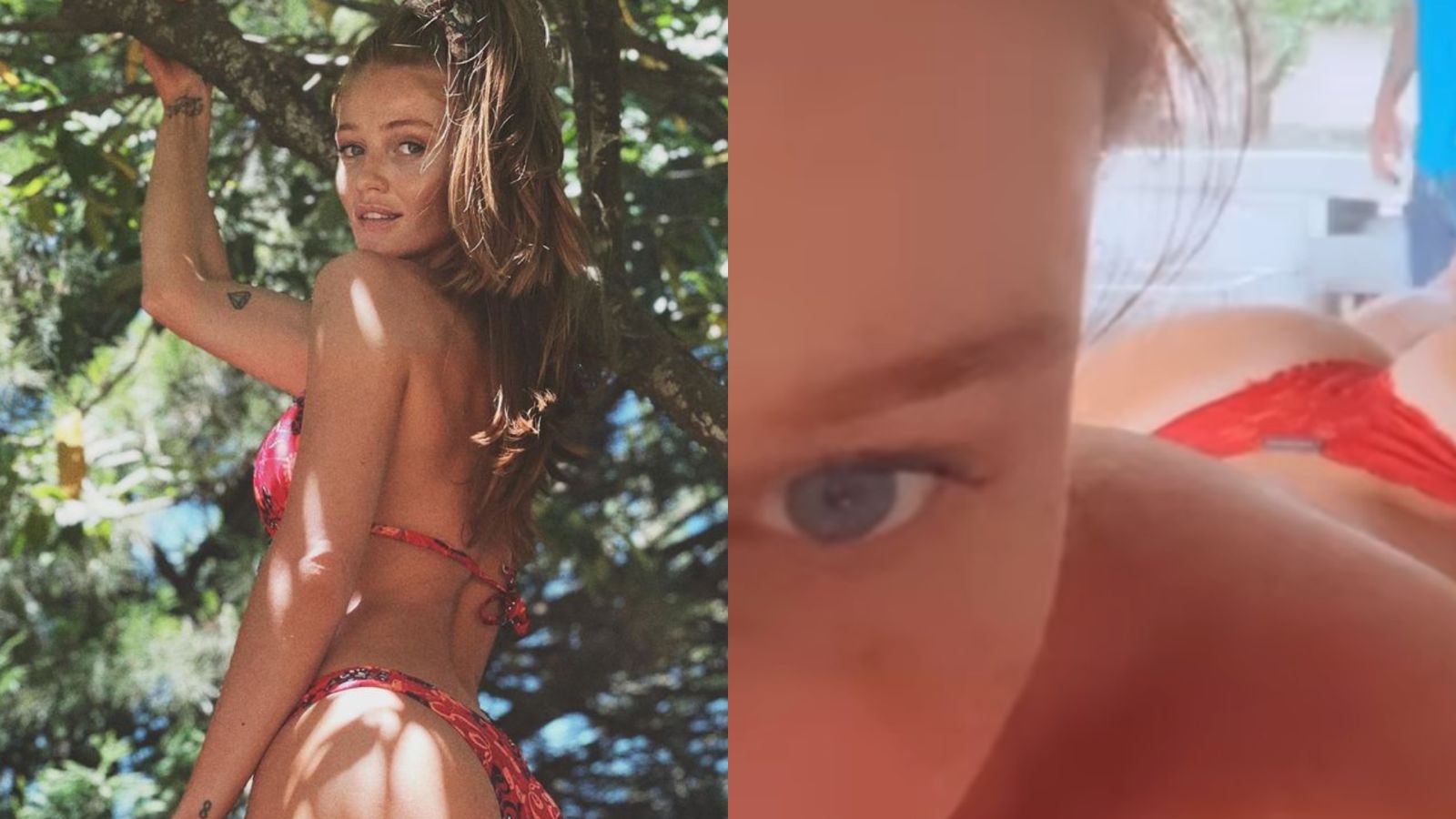 Cintia Dicker passa por tratamento para ficar com bumbum ‘na nuca’