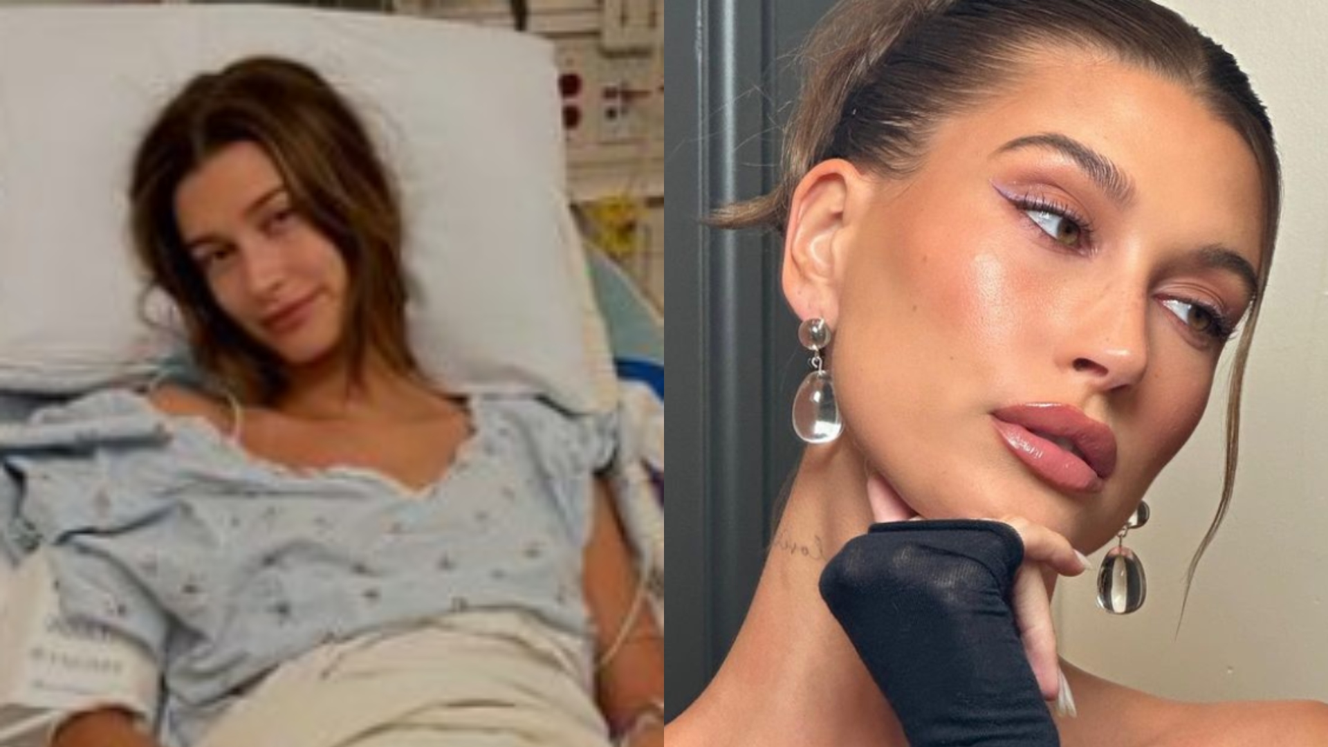 Hailey Bieber atualiza estado de saúde após um ano de sua cirurgia cardíaca
