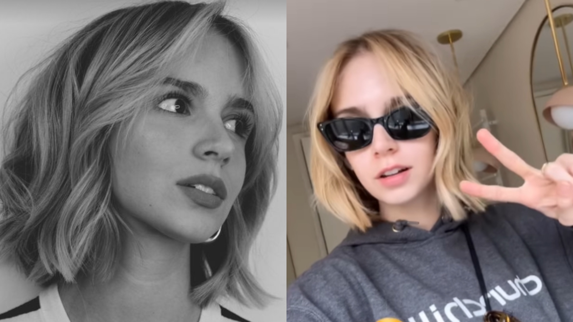 Isabella Scherer vai ao dentista e mostra boca torta por conta da anestesia