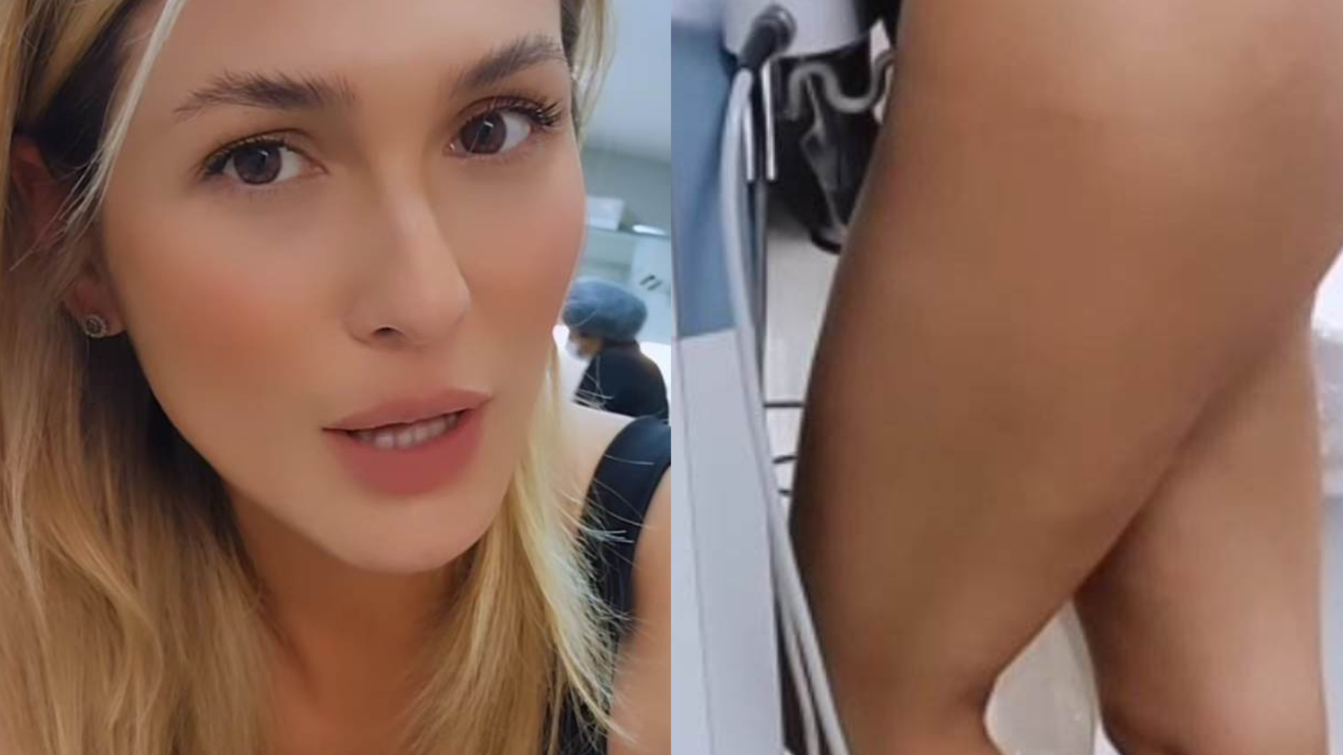 Lívia Andrade mostra bumbum após intervenção estética: ”Cavando”