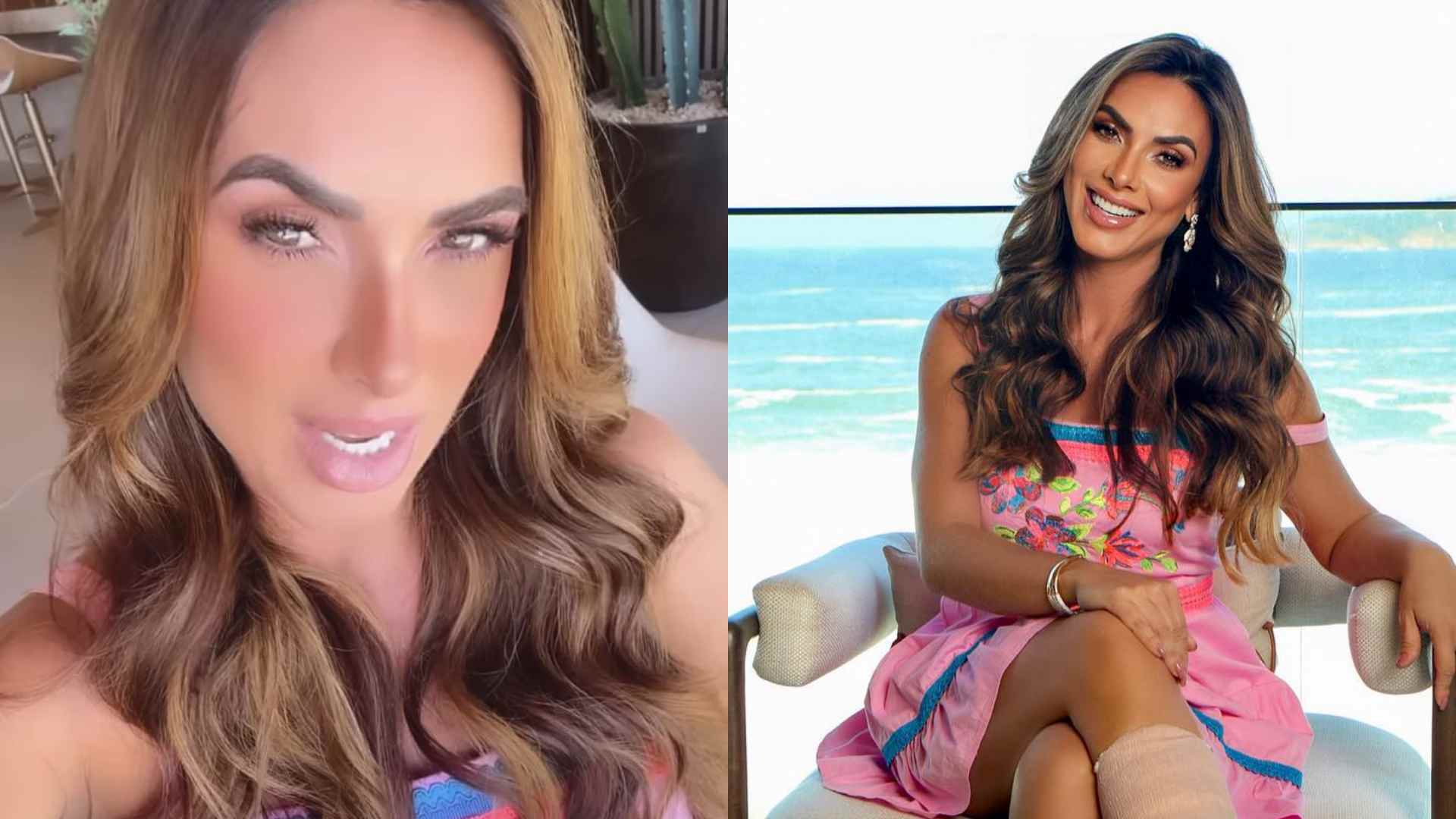 Nicole Bahls surge com o pé engessado e fala sobre recuperação após ser operada