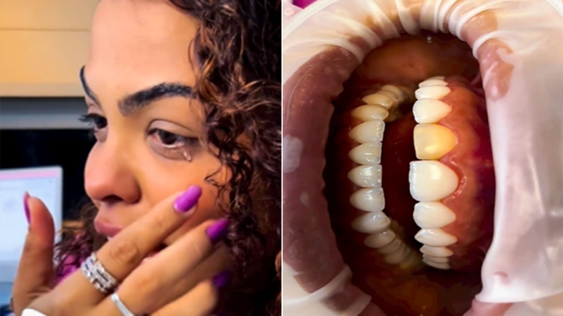 Ex-BBB Paula Freitas coloca lentes de contato nos dentes e chora