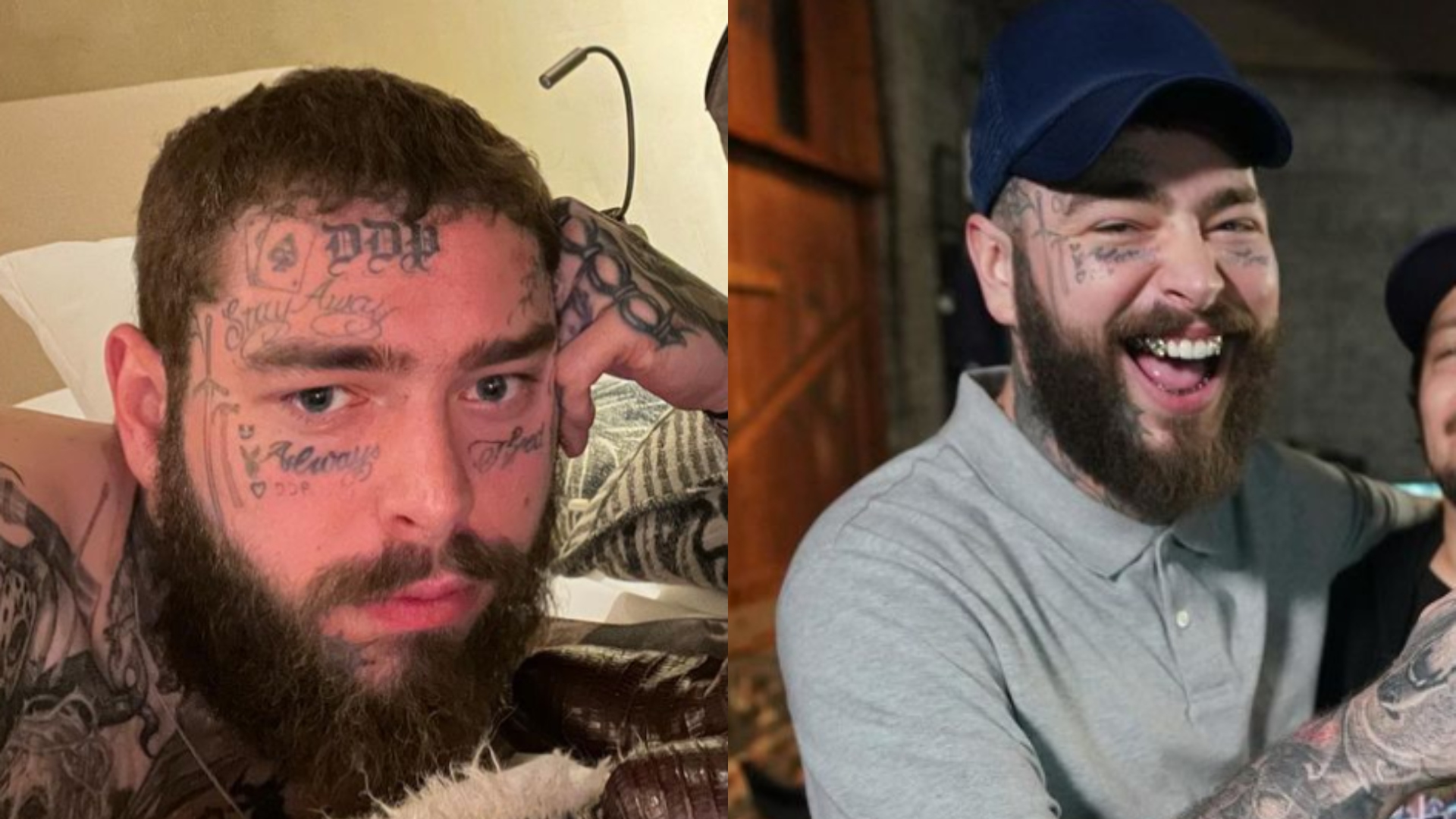 Post Malone revela verdadeiro motivo por trás de sua perda de peso