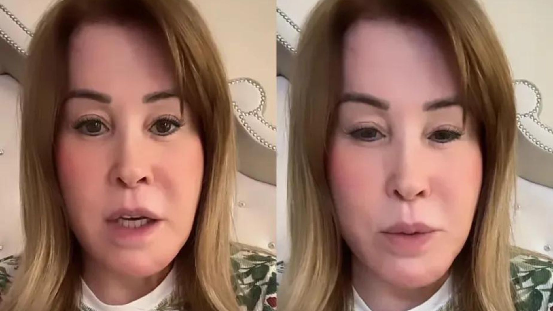 Zilu Camargo explica mudança no rosto após cirurgia: “Não me abandonem”