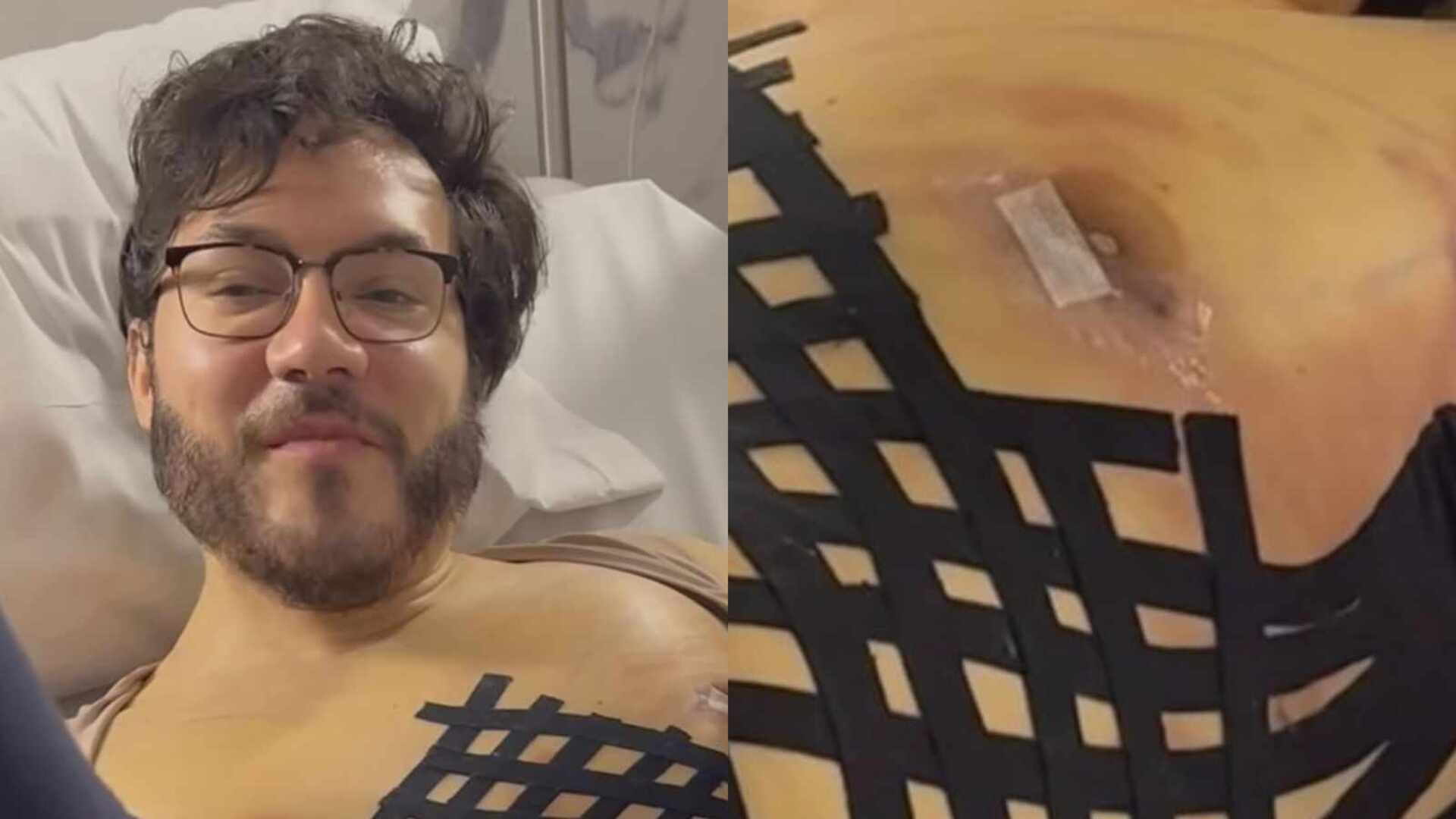 Eliezer mostra resultado de cirurgia de retirada de mamas: ”Era enorme”