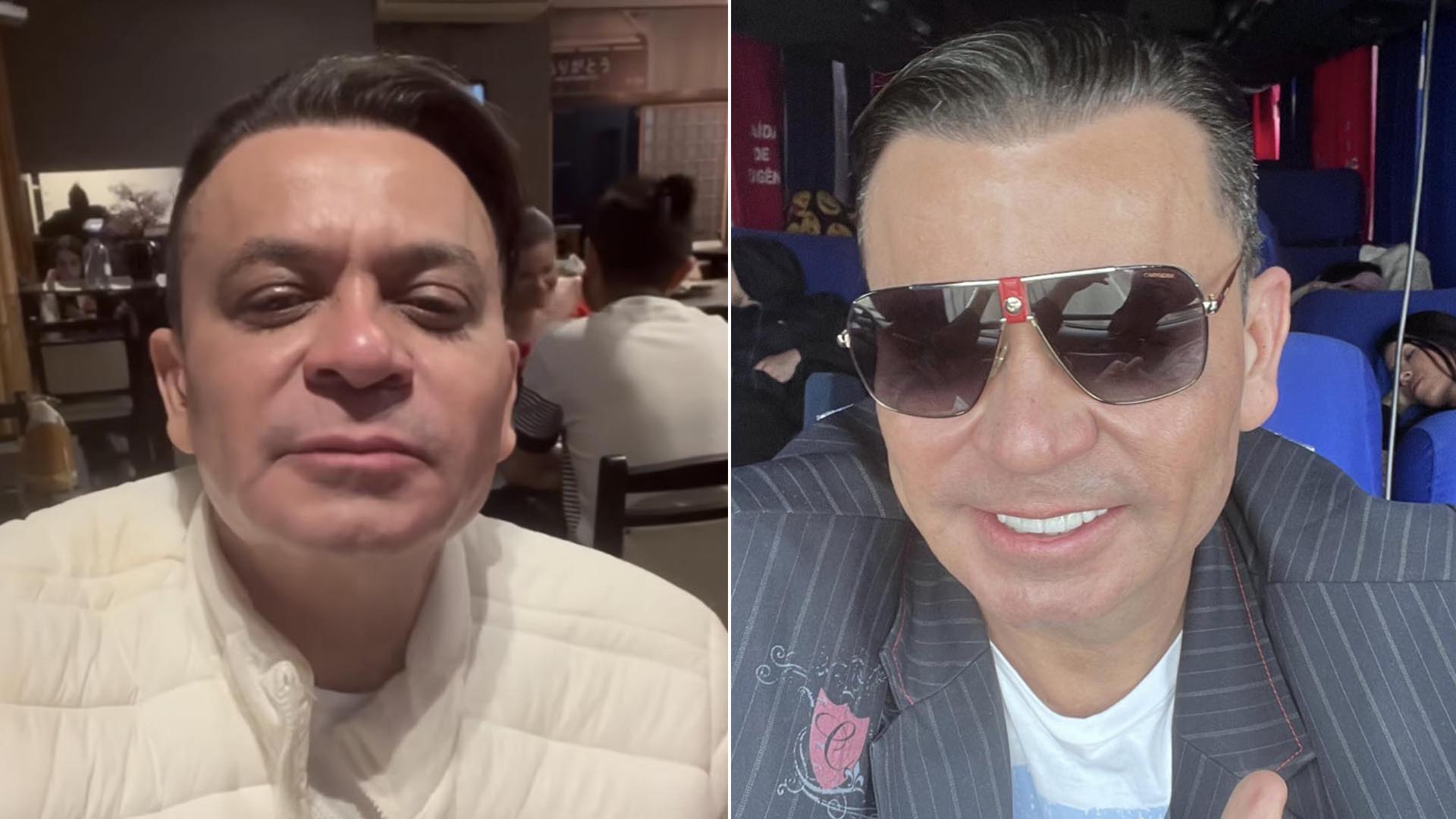 Frank Aguiar celebra harmonização facial e novo corte de cabelo: ‘Paguei minha promessa’
