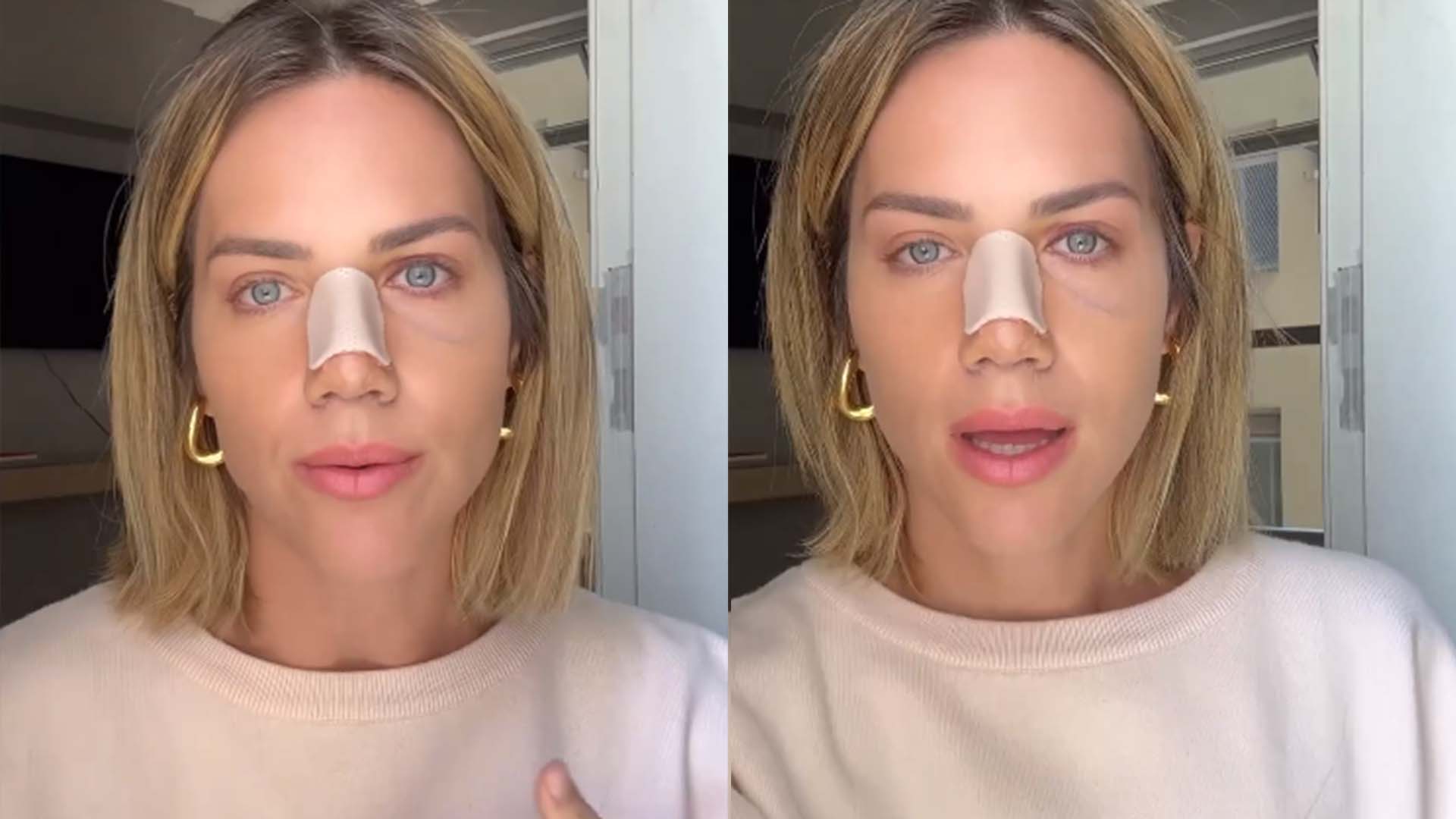 Giovanna Ewbank revela qual foi a cirurgia que realizou: ‘É funcional’