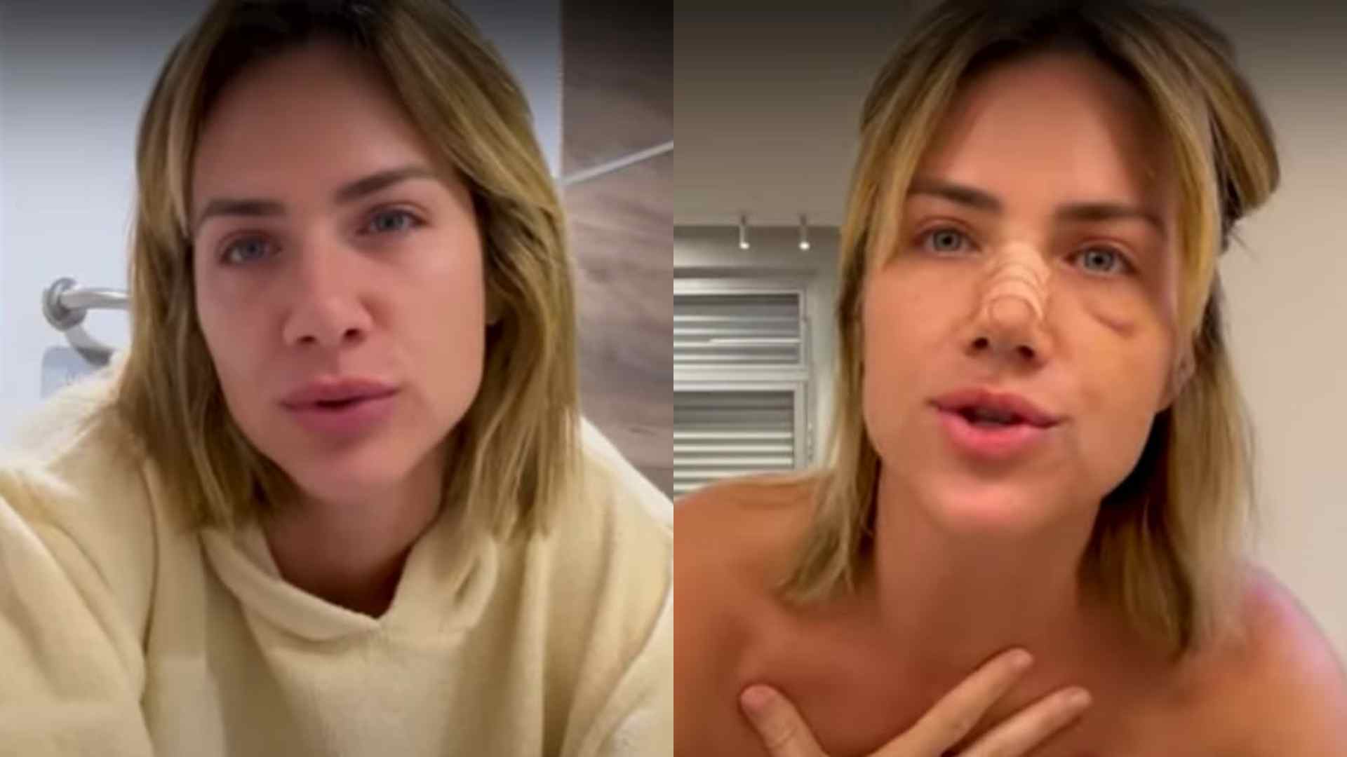 Giovanna Ewbank conta detalhes sobre cirurgia no nariz: “Minha maior motivação”