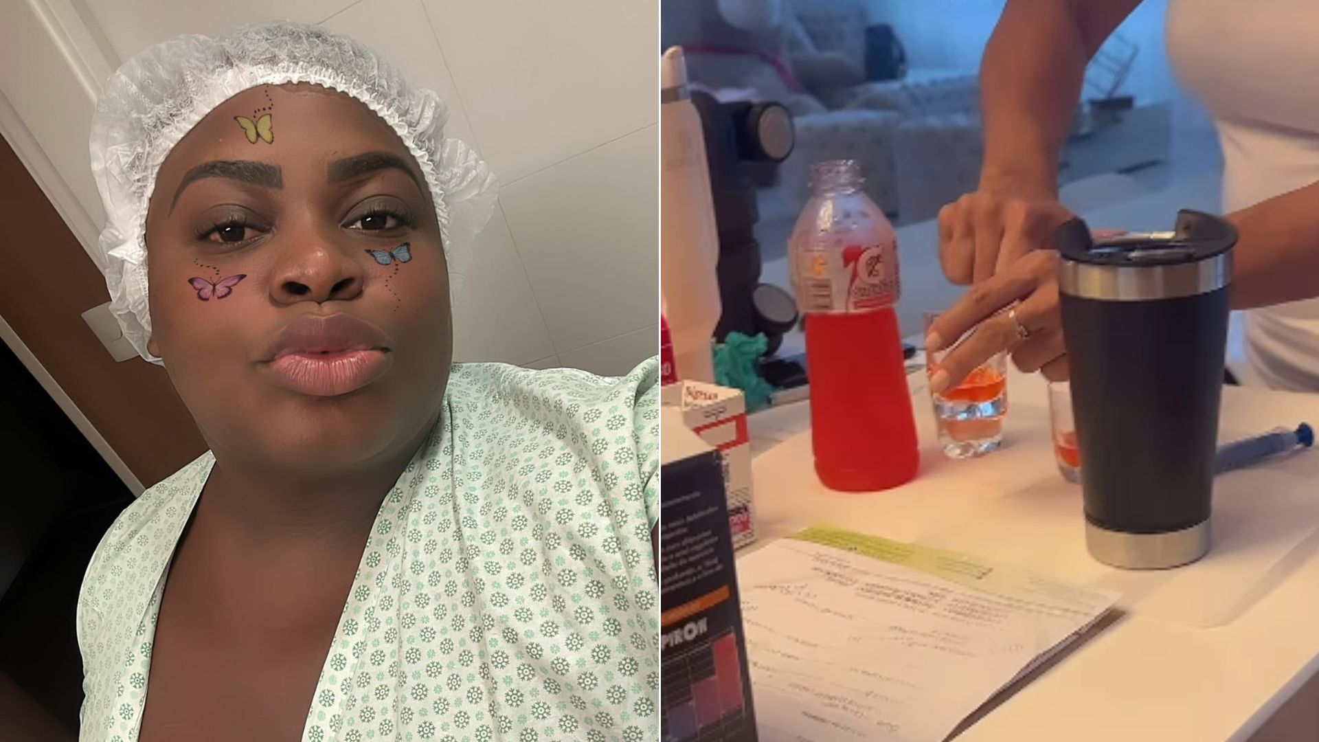 Jojo Todynho: Entenda o que pode ou não após cirurgia bariátrica