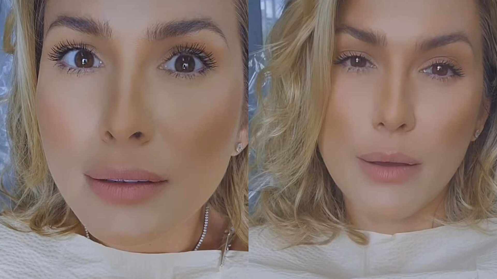 De novo? Lívia Andrade sofre ‘acidente’ e para em consultório: ”Acaba todinha”