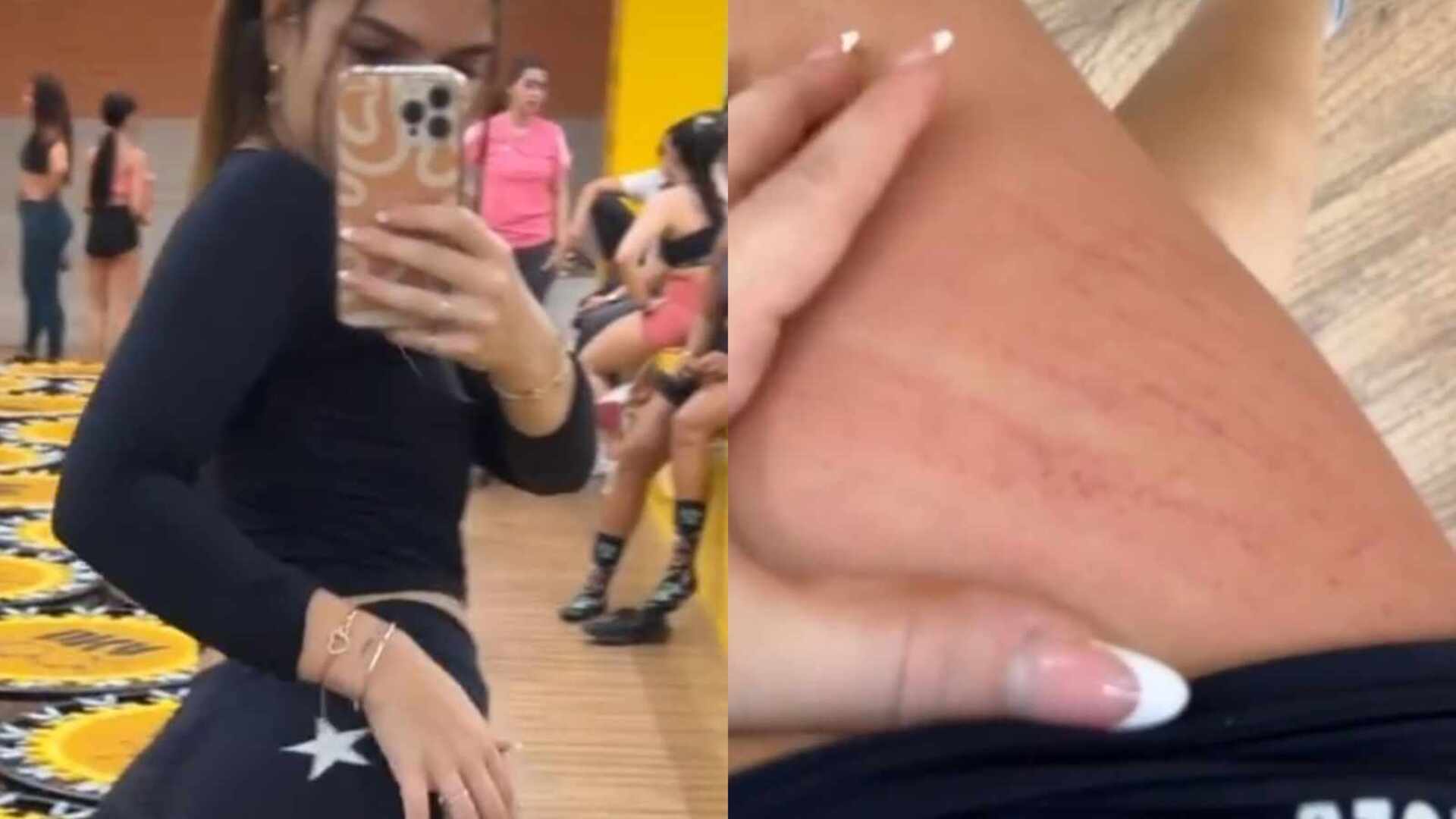 Mel Maia sofre com coceira no treino e choca ao dar close em pernões