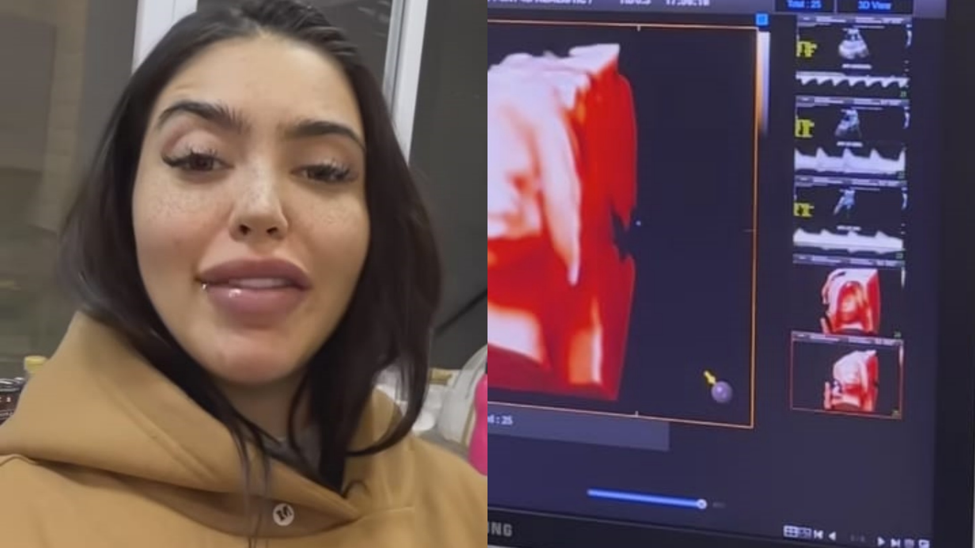 MC Mirella se emociona ao ver rosto da filha no ultrassom: “Nossa Sereninha”
