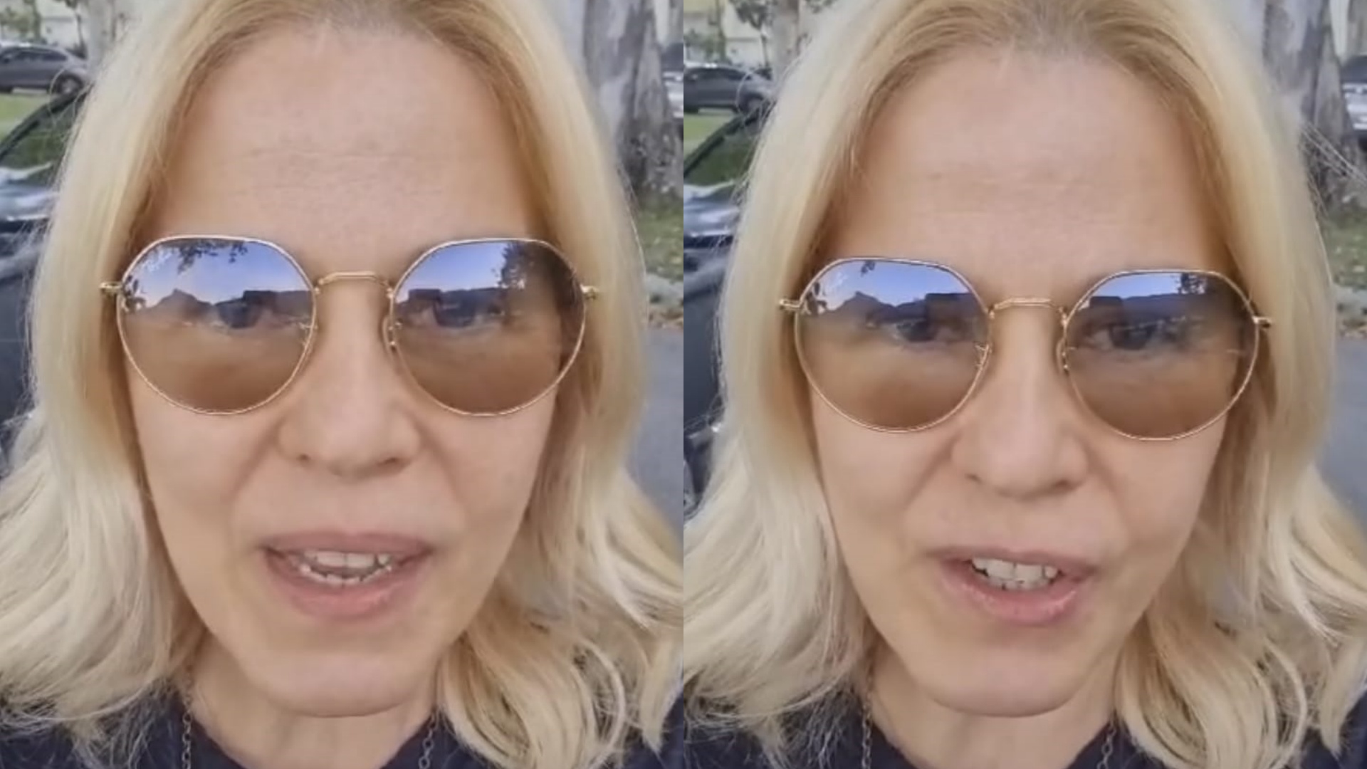 Paula Toller atualiza quadro de saúde após acidente doméstico