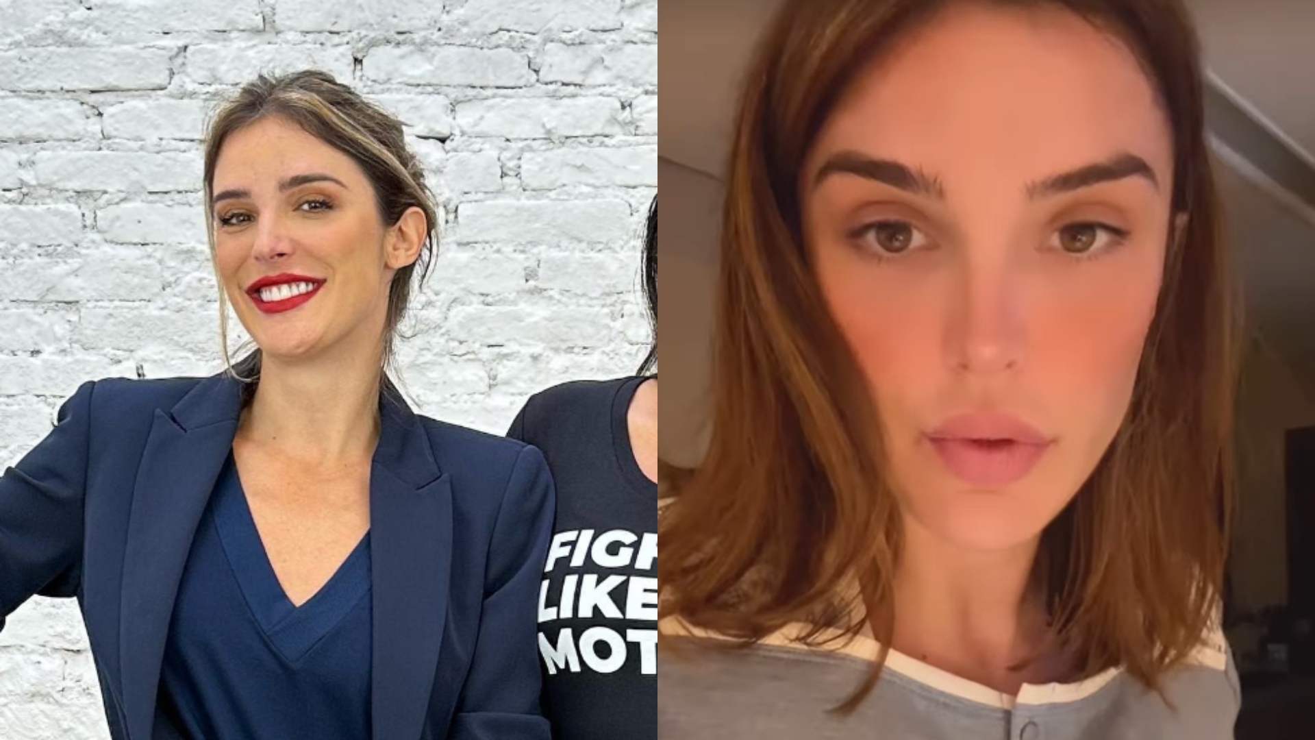 Rafa Brites abre o coração sobre diferença em seu rosto ao usar filtro