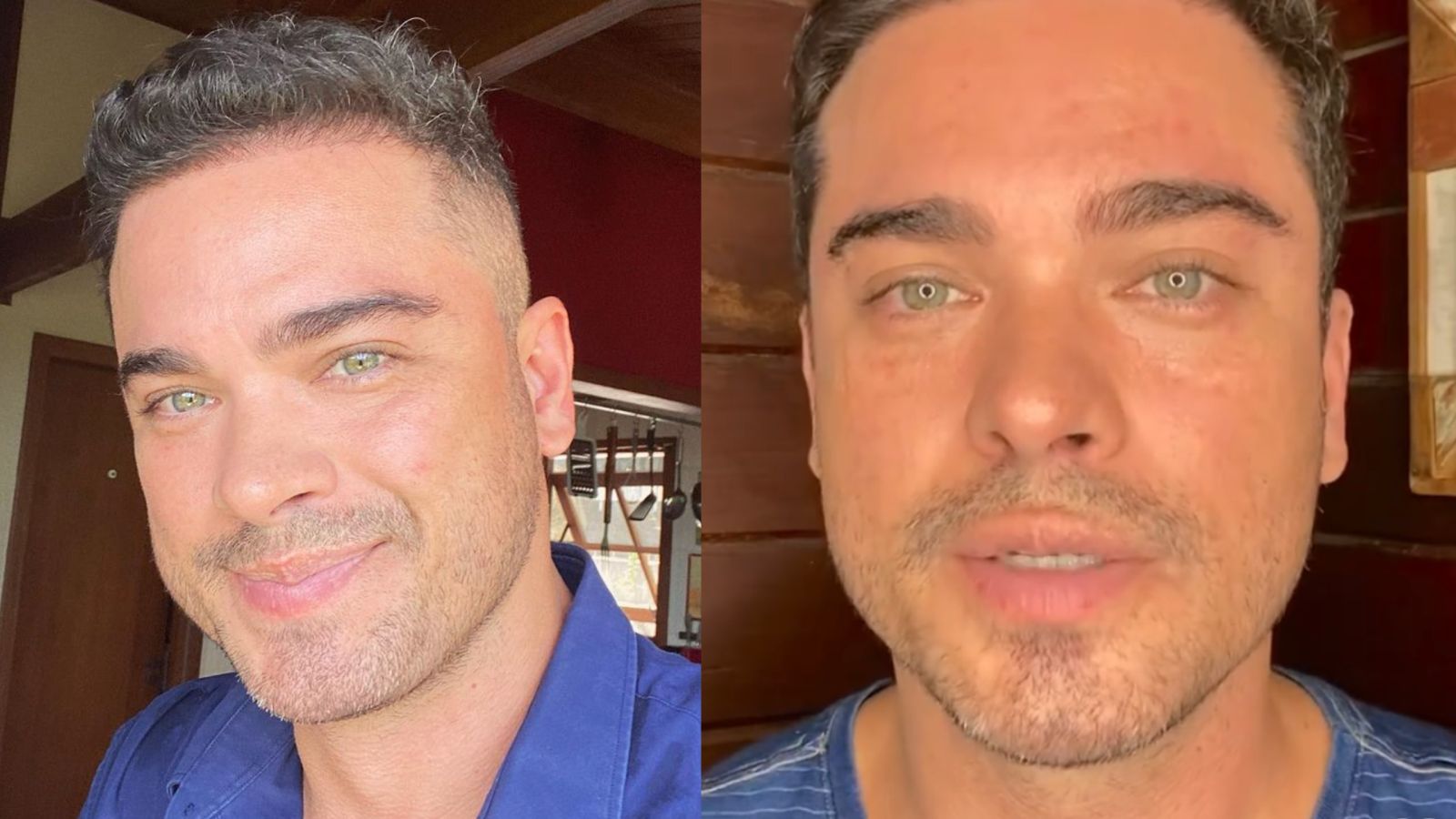 Sidney Sampaio revela que não esperava apoio após queda: “Muito surpreso”