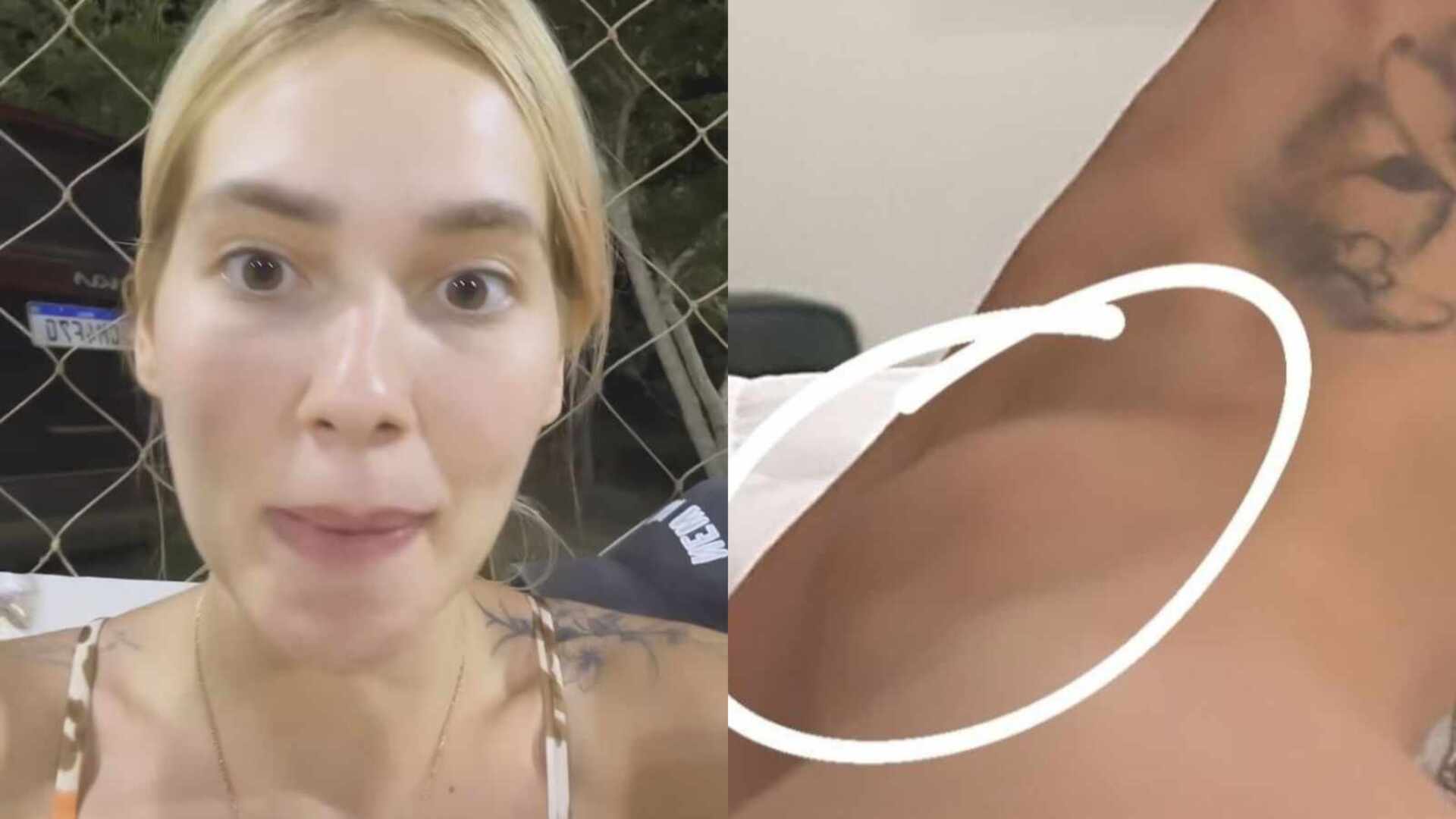 Virginia Fonseca se acidenta e mostra resultado: ”Bolona”