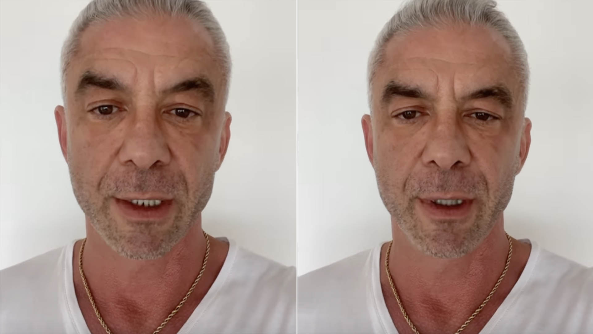 Ex-marido de Ana Hickmann faz declaração forte: ‘Pior que um câncer’