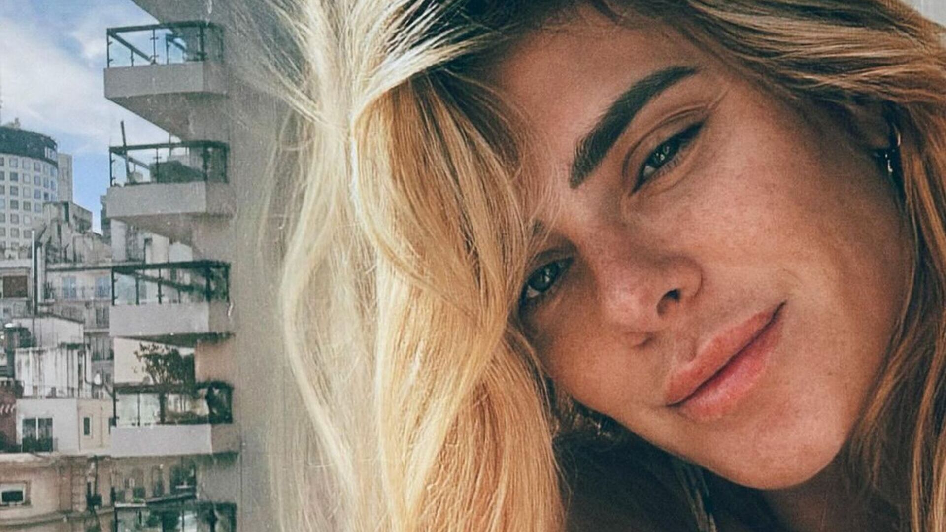 Carolina Dieckmann se exibe de camisola e é elogiada ao mostrar melasma