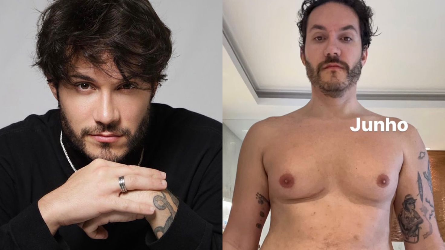 Eliezer exibe ‘antes e depois’ do corpo após lipoaspiração e ginecomastia