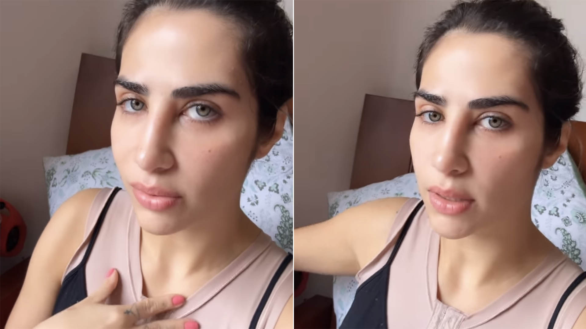 Filha de Leonardo enfrenta problema após cirurgia plástica