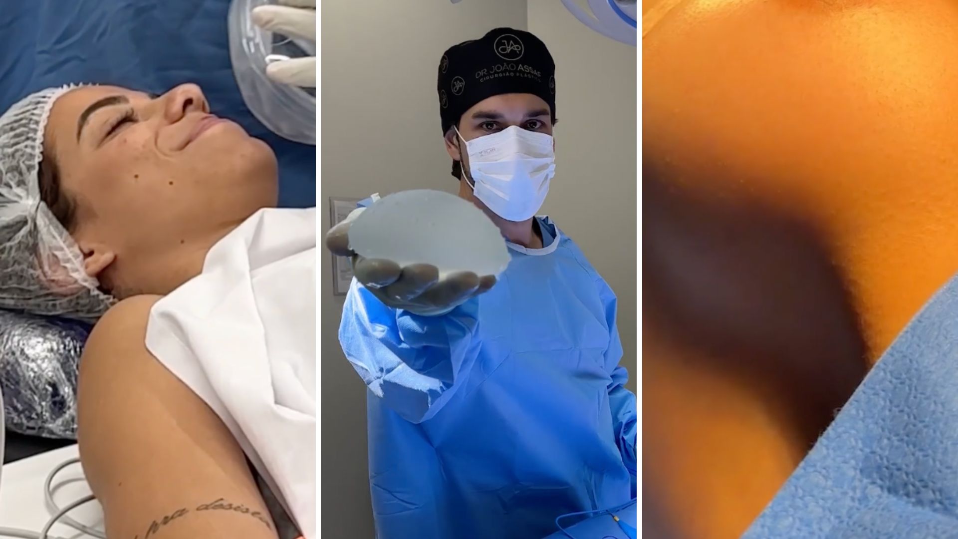 “Realizada”: Key Alves mostra antes e depois após colocar silicone