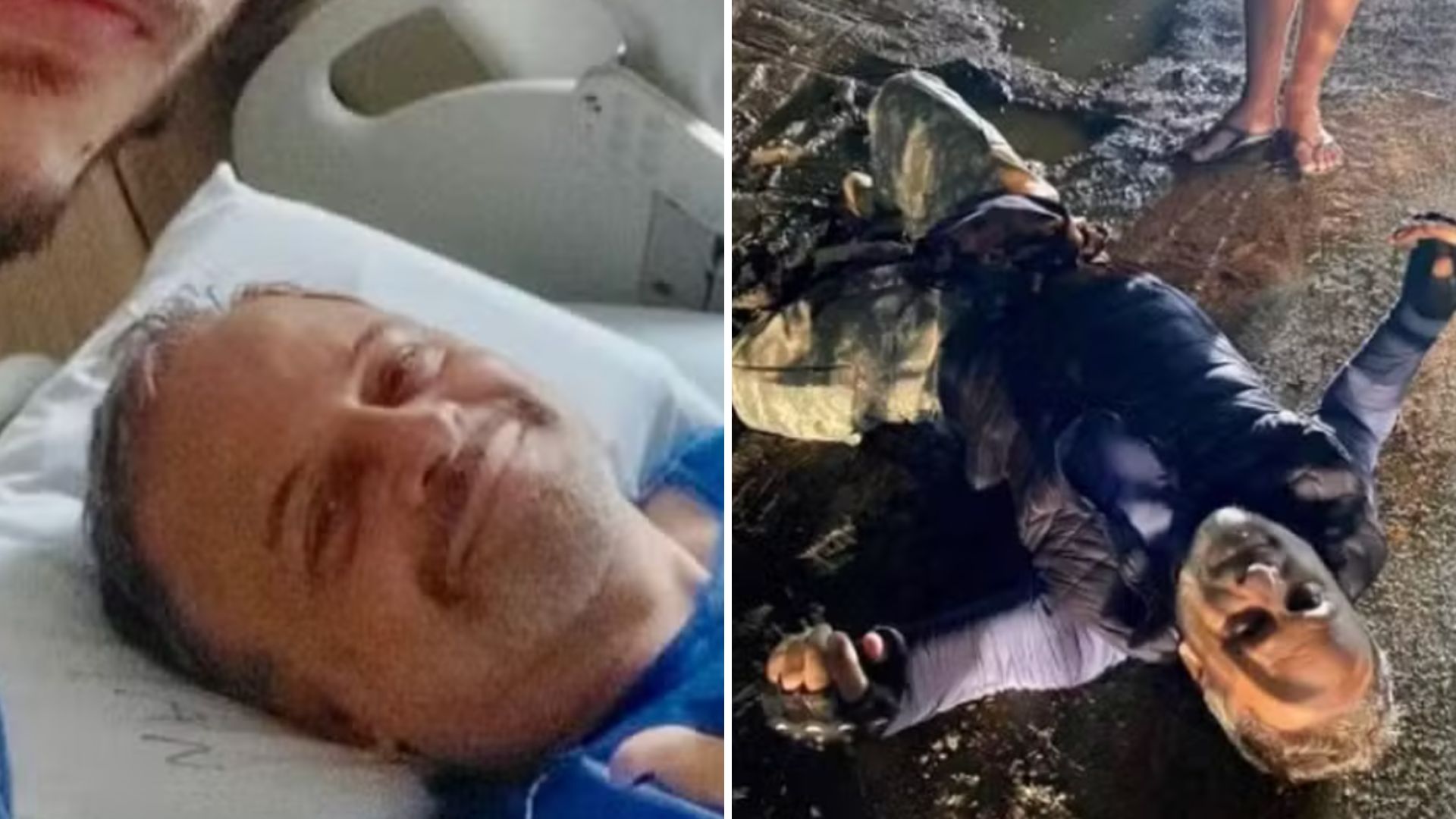 Marcos Breda enfrenta calvário e passa pela sexta cirurgia: “52 pontos”