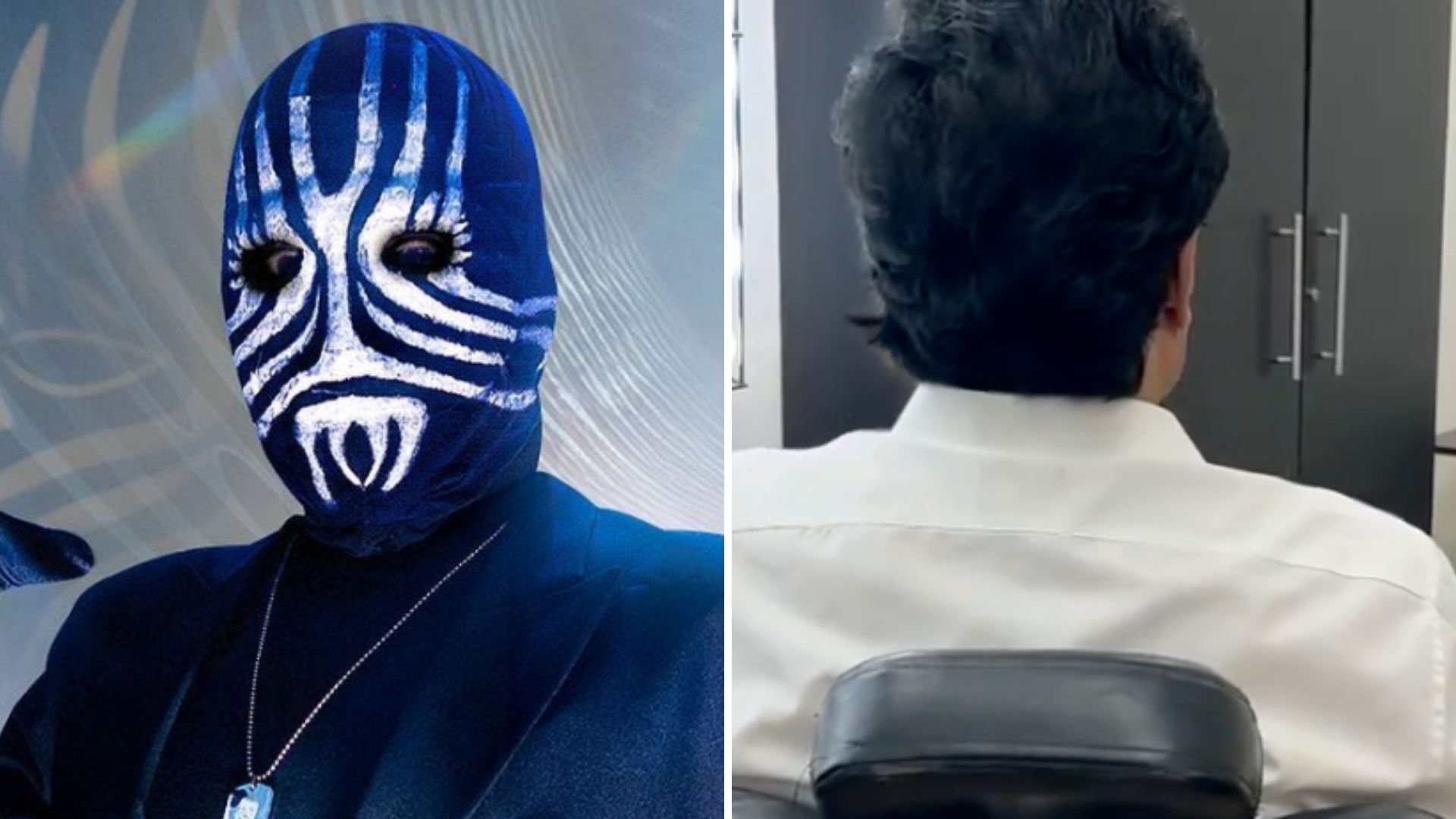 Lembra dele? Mister M passa por harmonização facial e exibe novo rosto