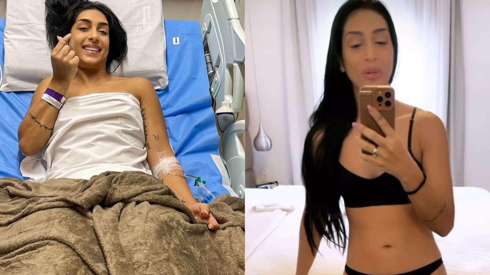 Amanda Djehdian mostra resultado da cirurgia de lipedema