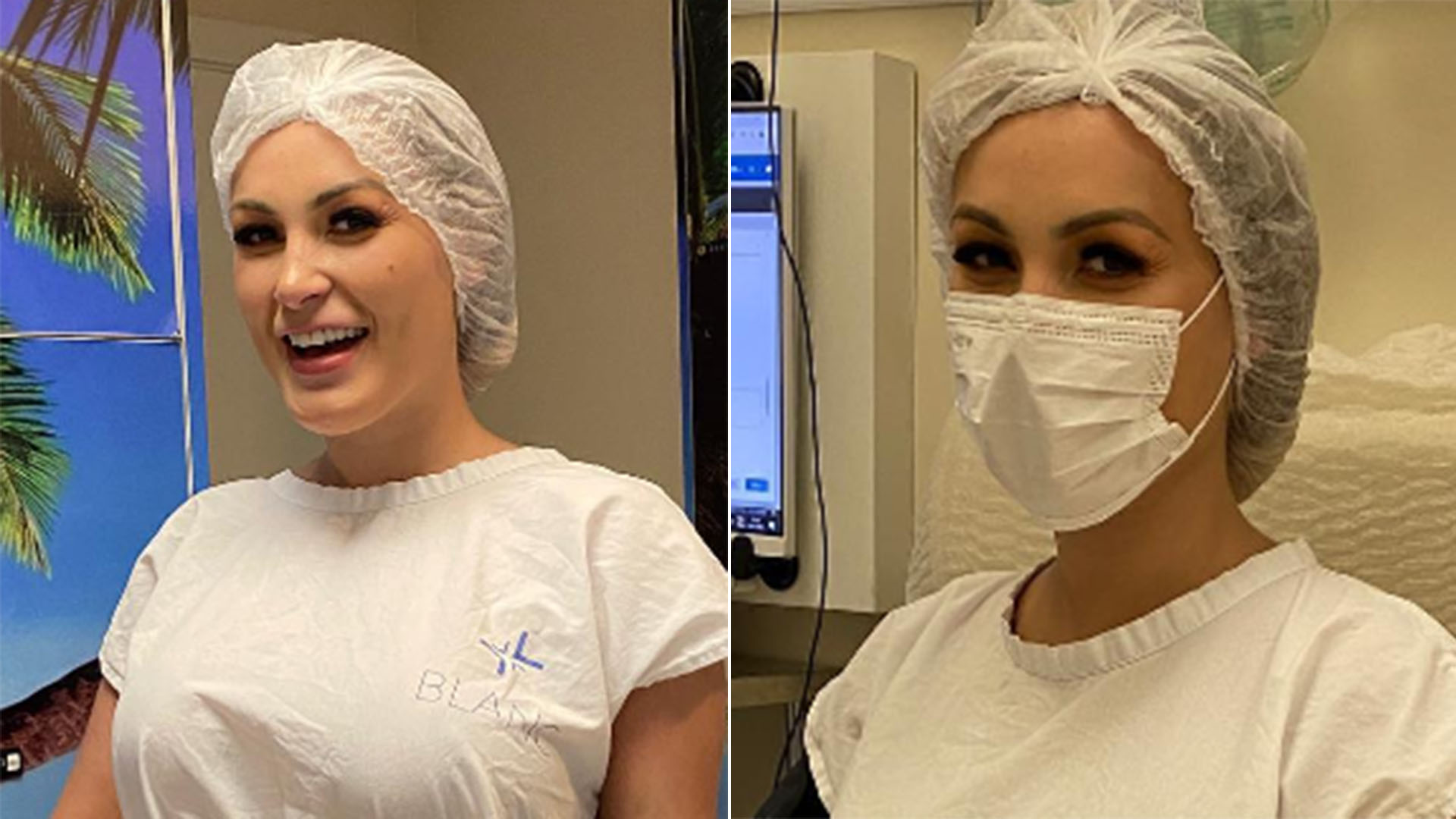 Andressa Urach passa por nova cirurgia plástica após sofrer complicações do hidrogel