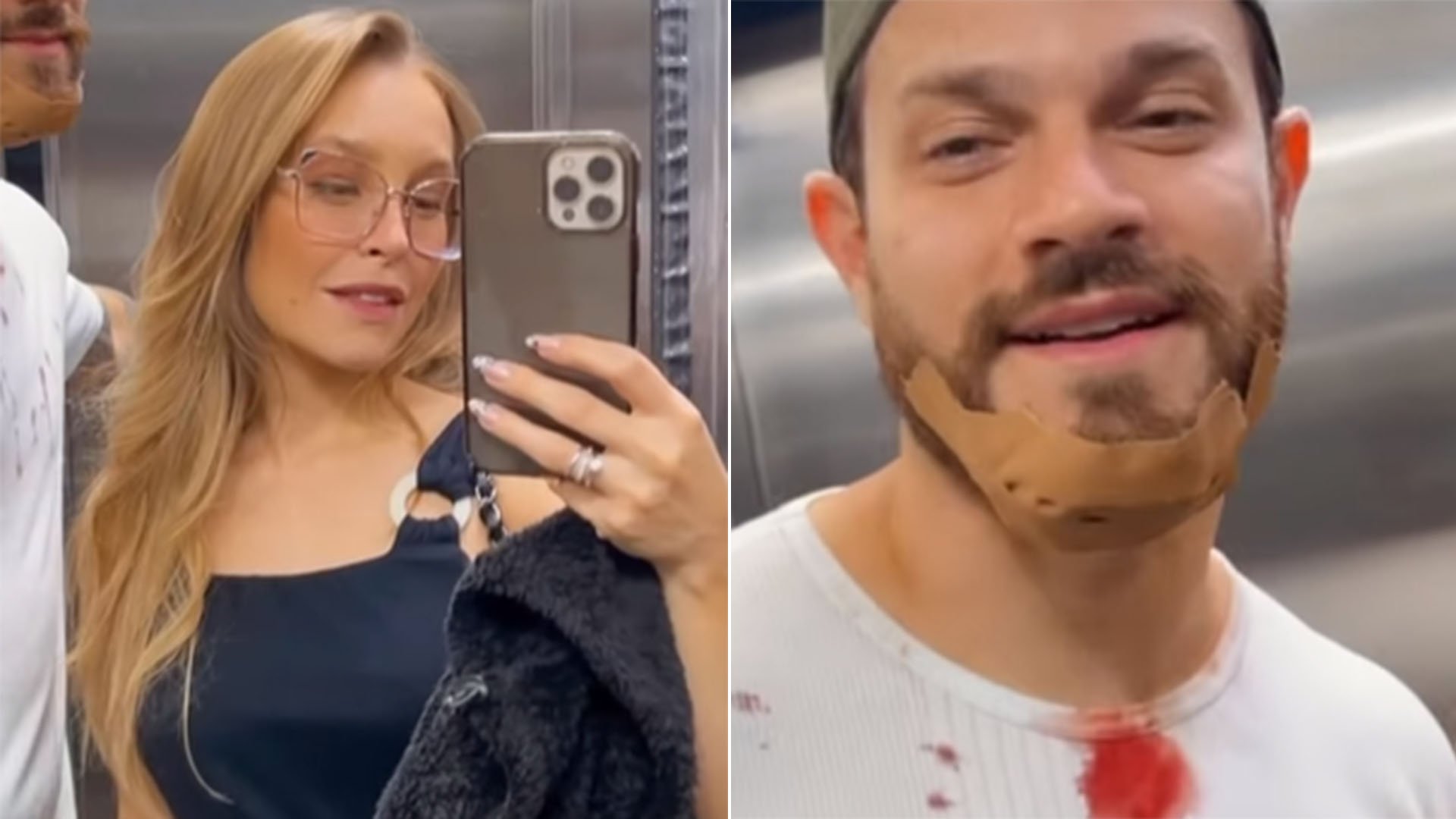 Carla Diaz mostra o noivo sujo de sangue após acidente: ‘Vai levar ponto’