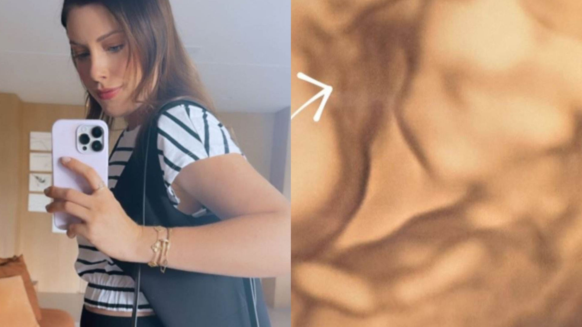 Fabiana Justus mostra o rostinho do filho no ultrassom: ”Perfil dele”