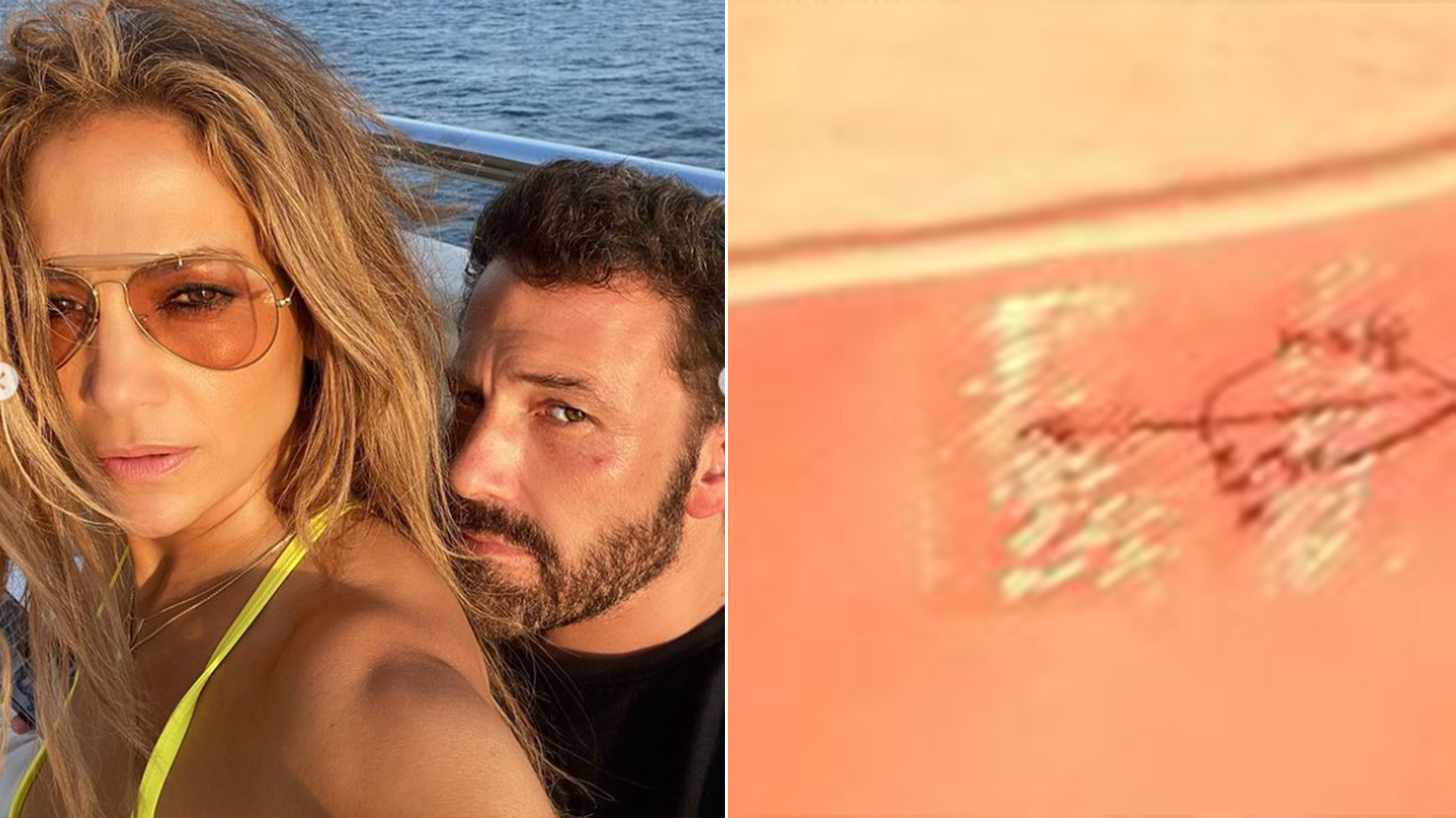 Jennifer Lopez faz tatuagem combinando com Ben Affleck