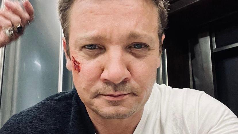 Após acidente, Jeremy Renner compartilha vídeo se exercitando: “O que for preciso”