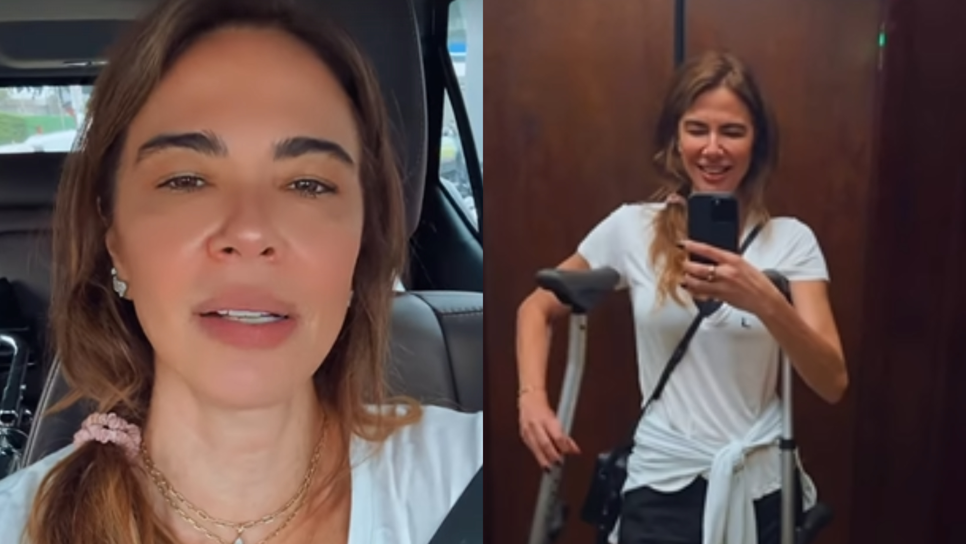 Luciana Gimenez exibe cicatrizes um mês após grave acidente na neve