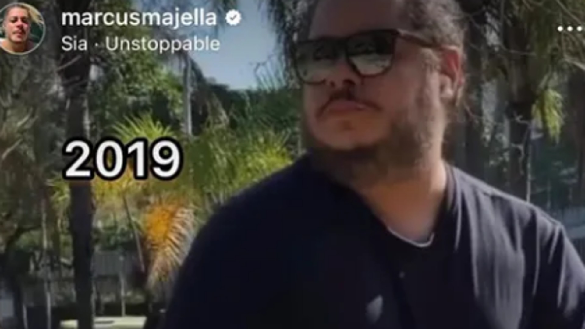 Marcus Majella mostra antes e depois impressionante após emagrecer
