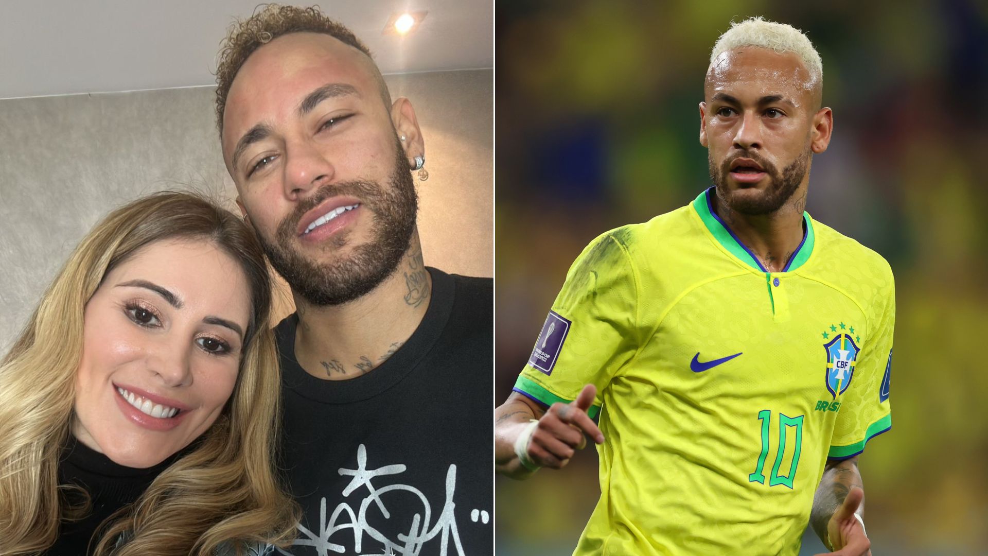 O que Neymar fez no rosto? Entenda como funcionam os procedimentos liftera e futera