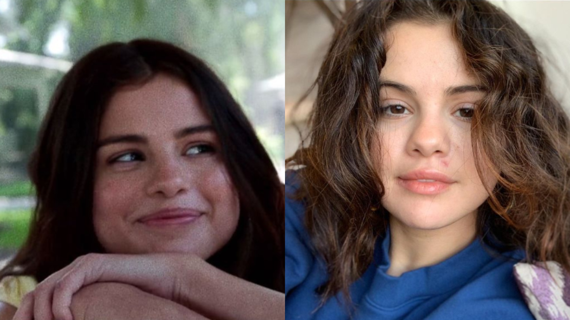 Selena Gomez fala sobre ganho de peso por conta de medicação para doença